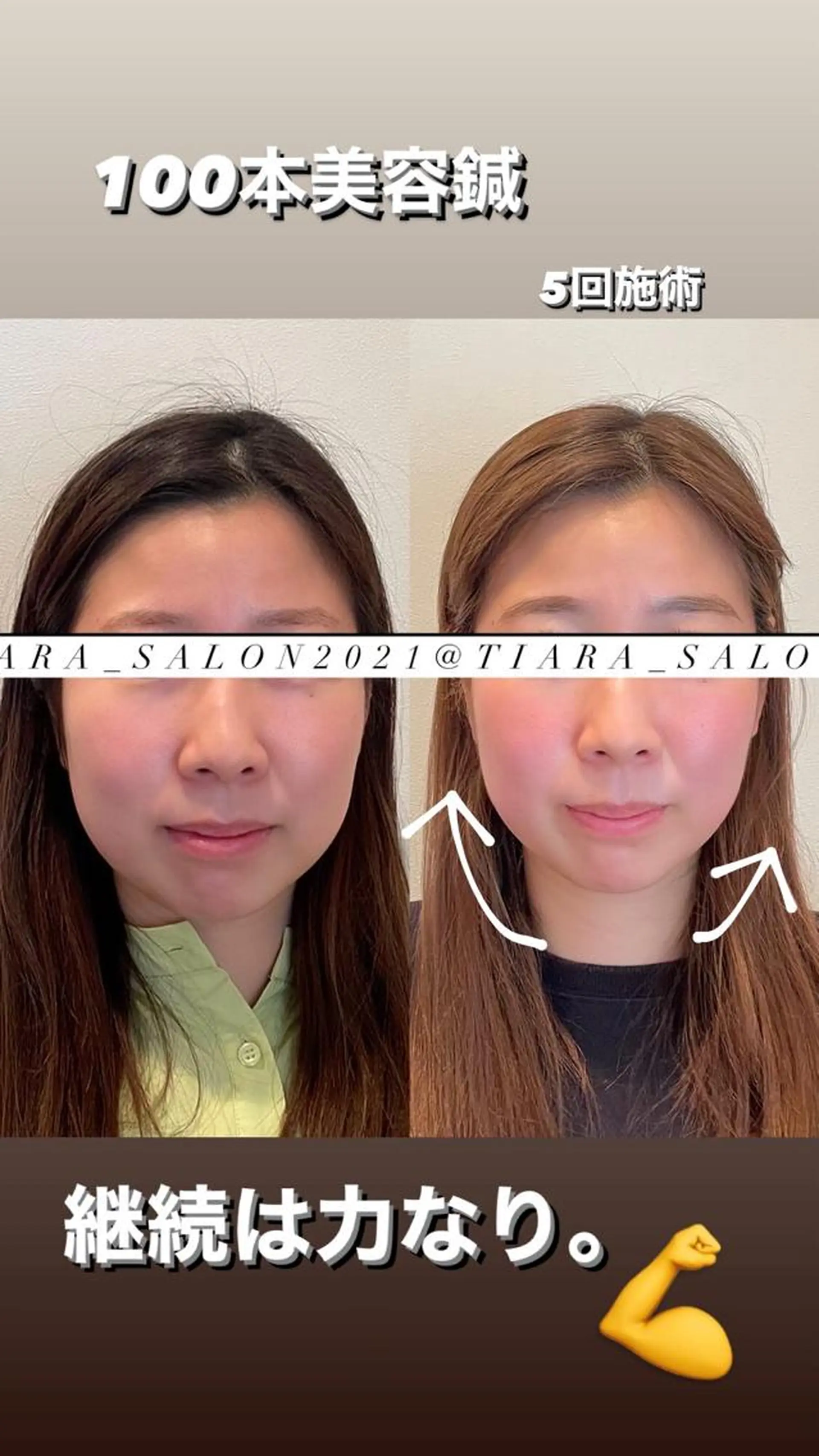 ロング カラー パーマ ヘアアレンジ メンズ キッズ ネイル マツエク・マツパ アイブロウ 結婚式・ブライダル 結婚式・ブライダル ブライダルネイル 鍼灸サロン TIARA　美容鍼のエステ・リラクイメージ