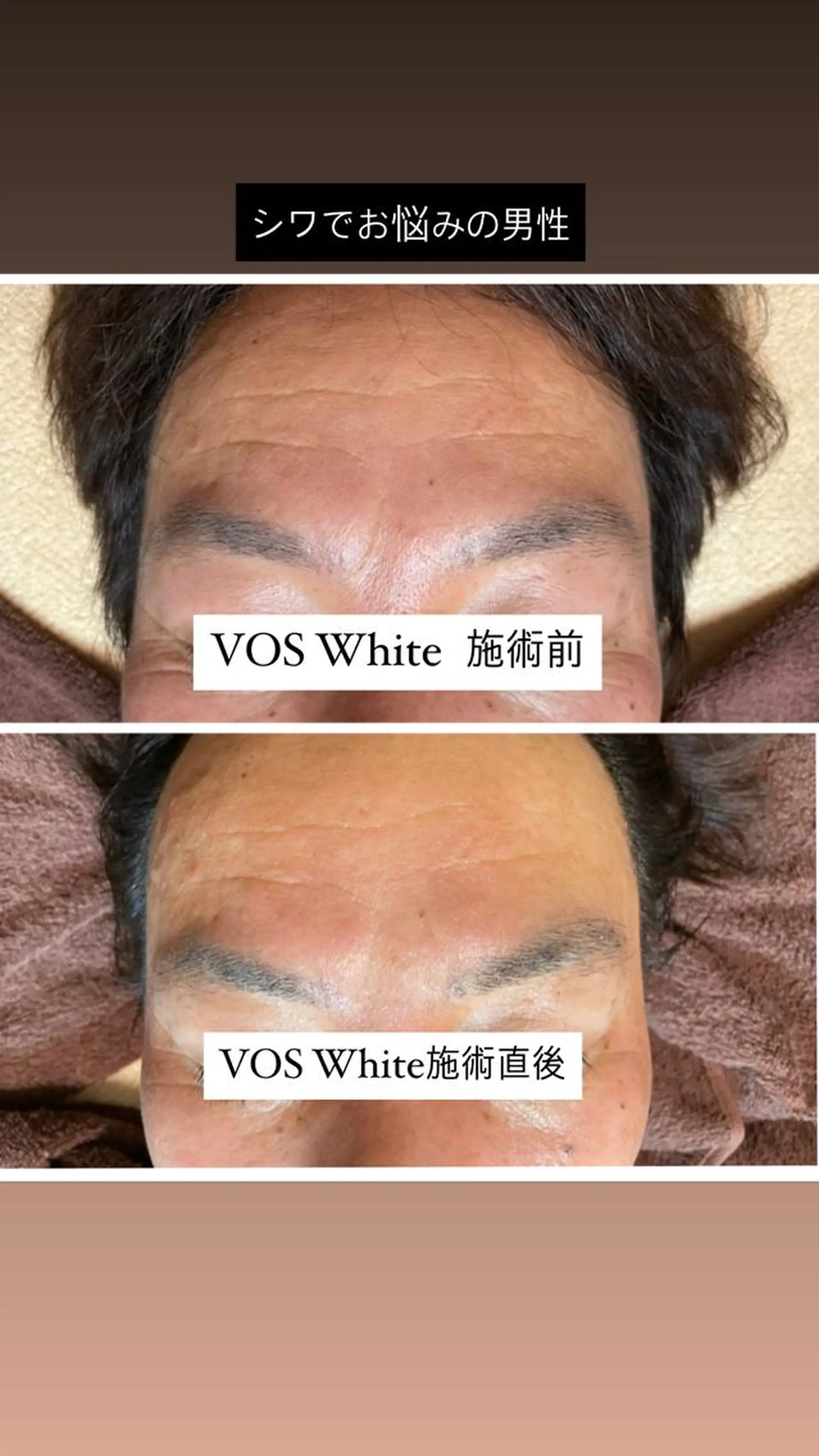 代表 MOMOのエステ・リラクイメージ