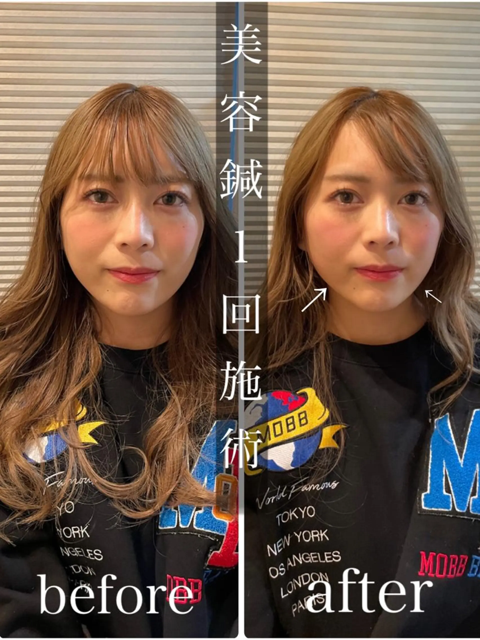 鍼灸 Refineのその他イメージ