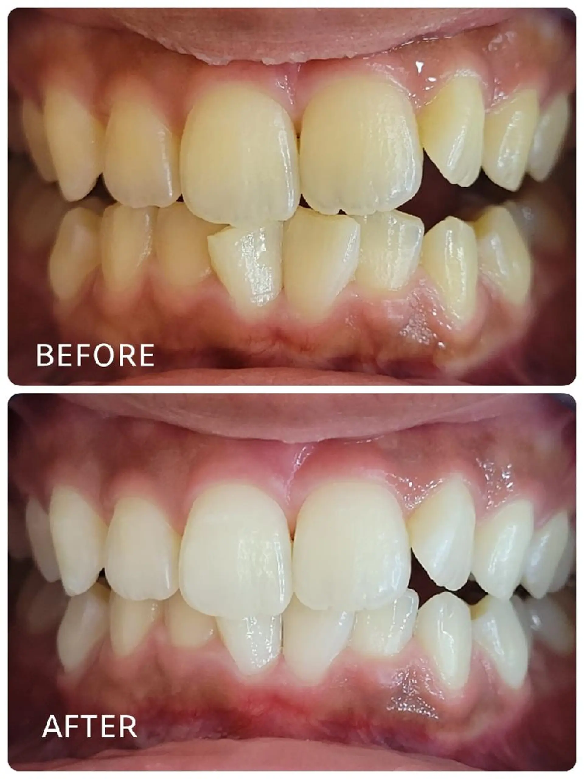 ホワイトニングサロン ラウレアのその他イメージ