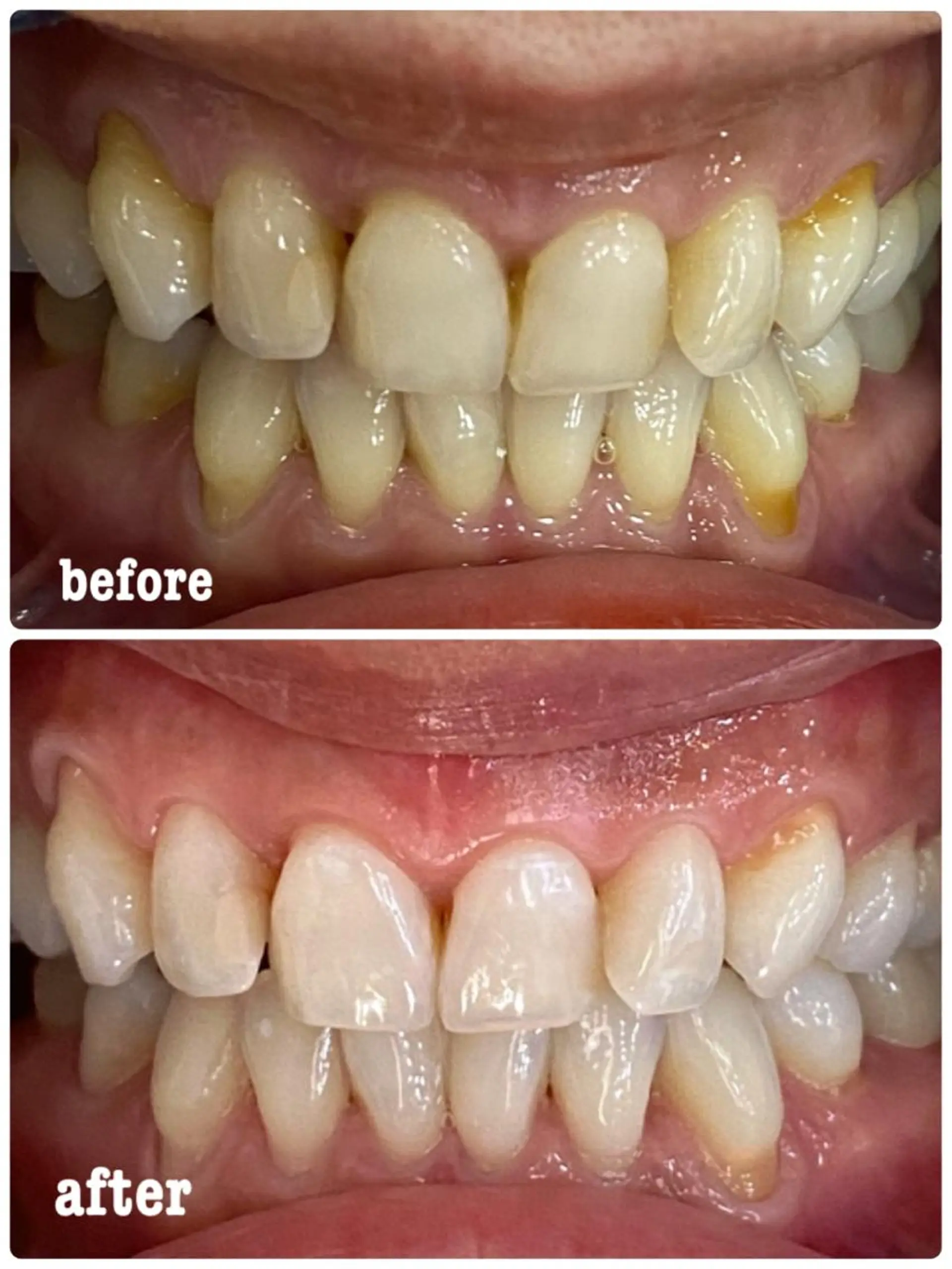 ホワイトニングサロン ラウレアのその他イメージ