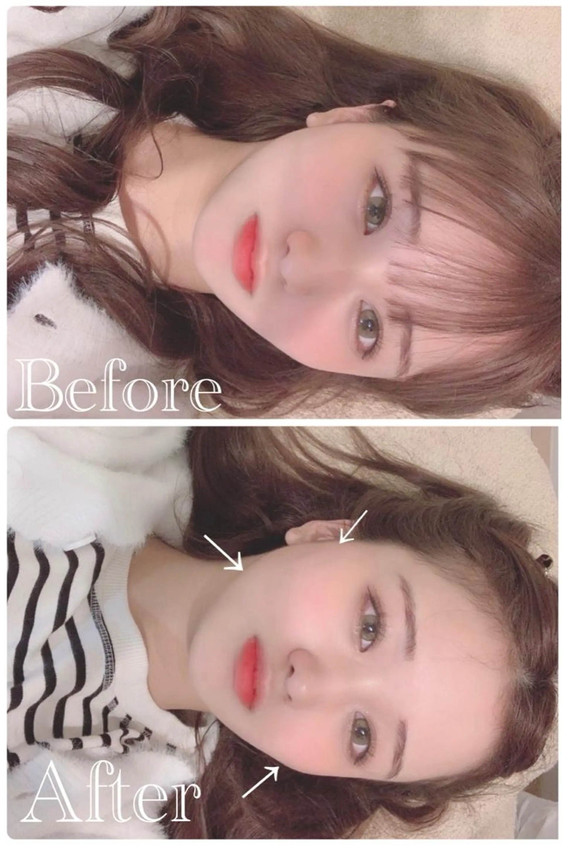 鍼灸 Refineのその他イメージ