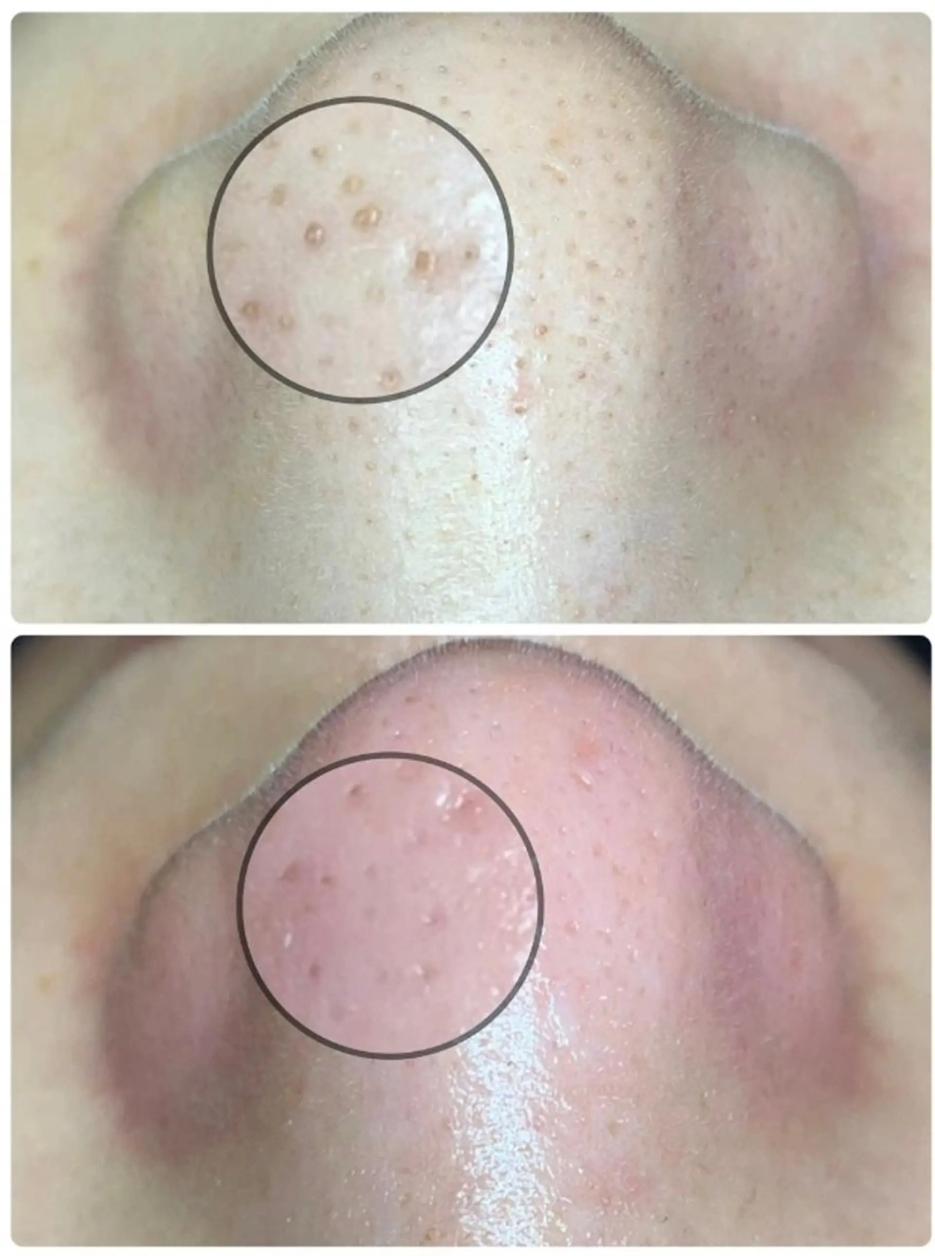 その他 ピーリング専門サロン Spicaのエステ・リラクイメージ