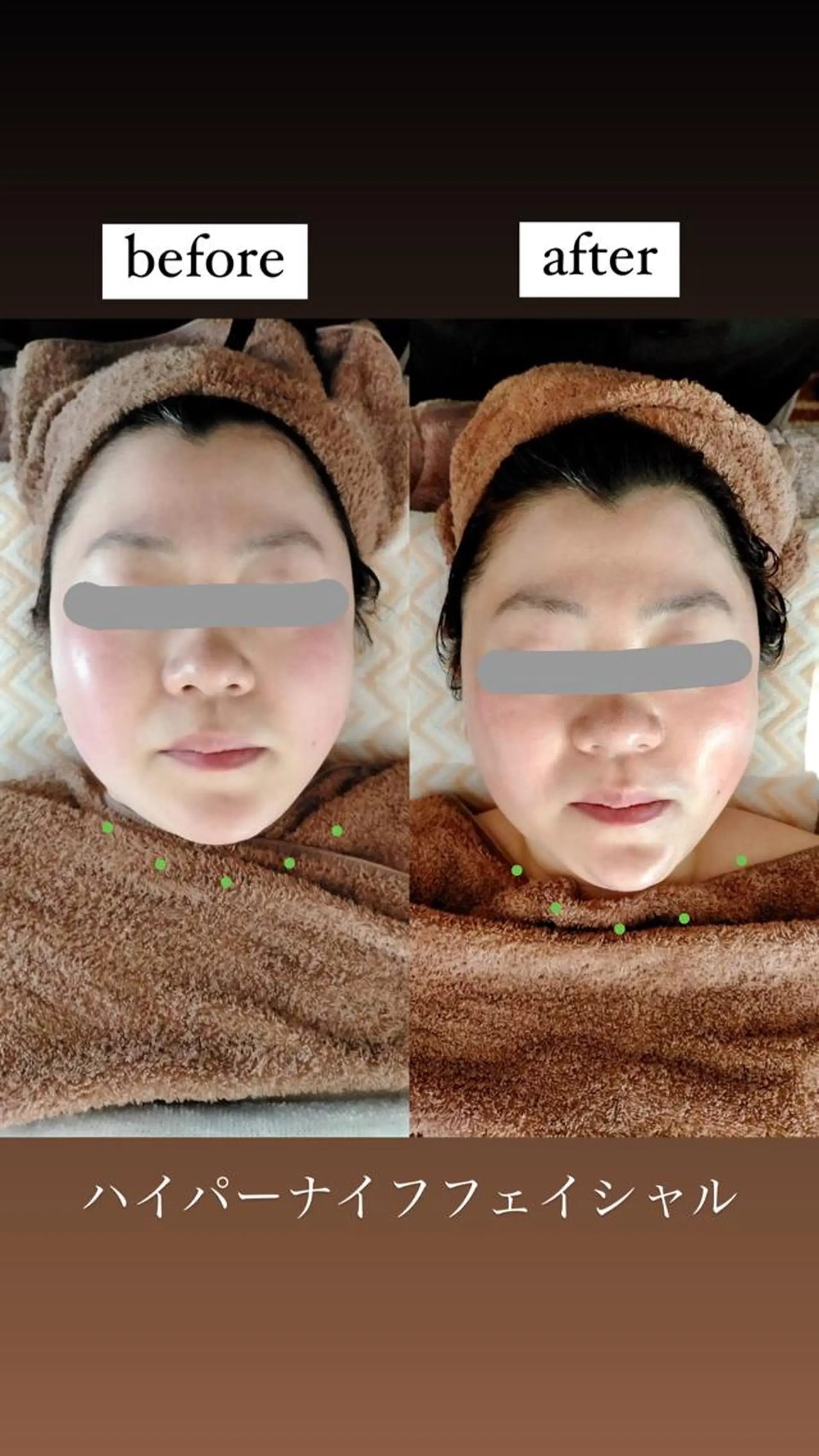 km retreat mentのエステ・リラクイメージ