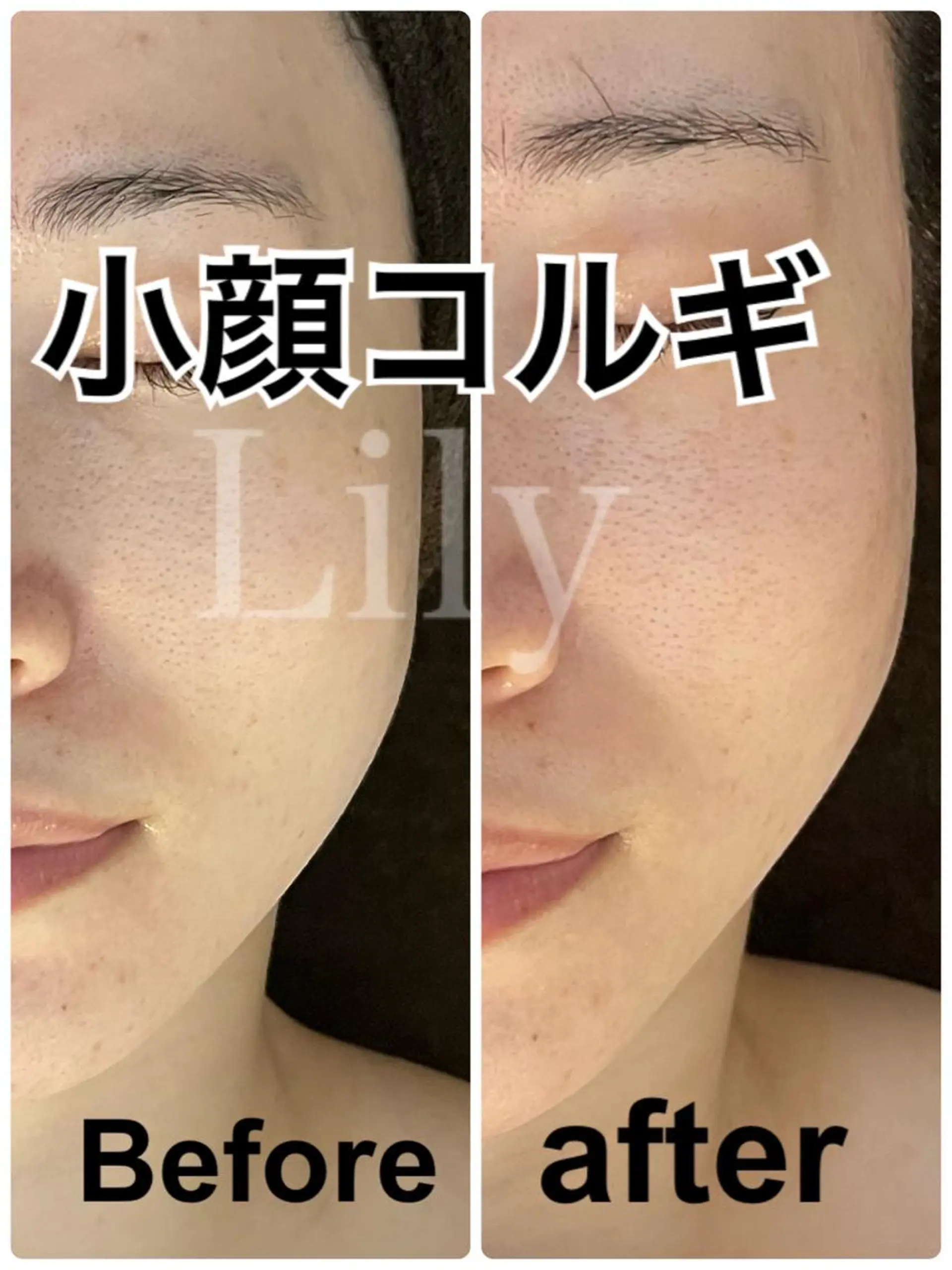 エステ トータルビューティー サロンLilyのエステ・リラクイメージ