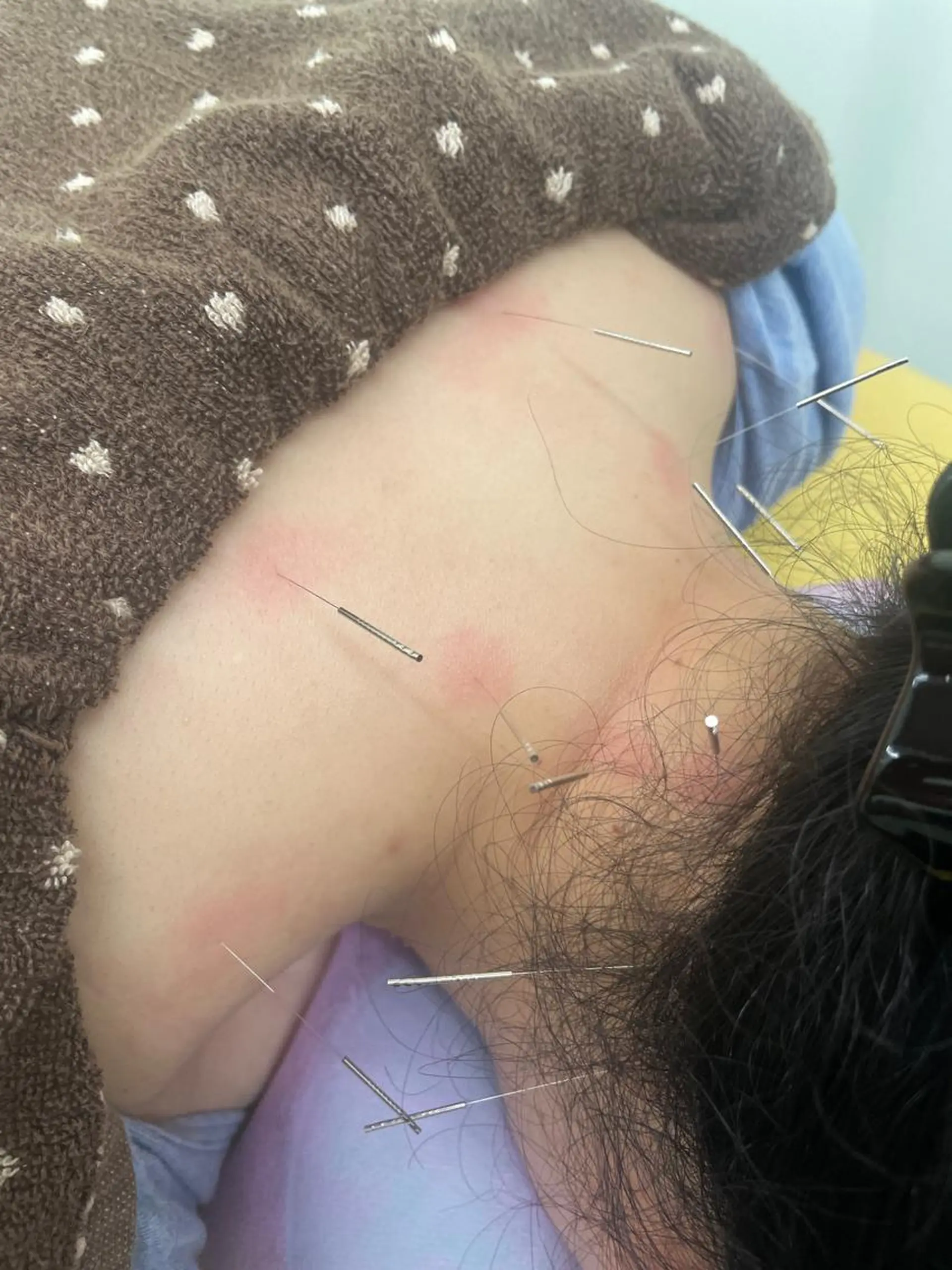 スマイル鍼灸接骨院・りらっくす　すまいる所属・スマイル鍼灸接骨院 /交通事故治療のその他イメージ