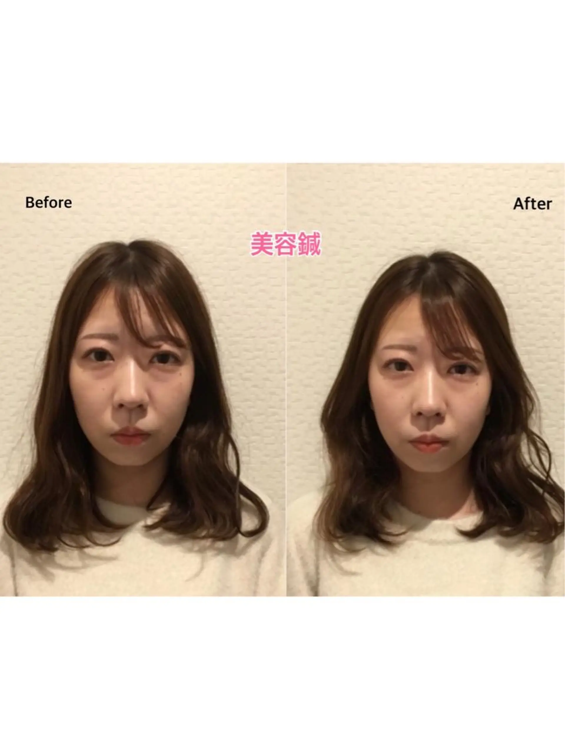 チキバン美容鍼灸整体 サロン心斎橋店のエステ・リラクイメージ