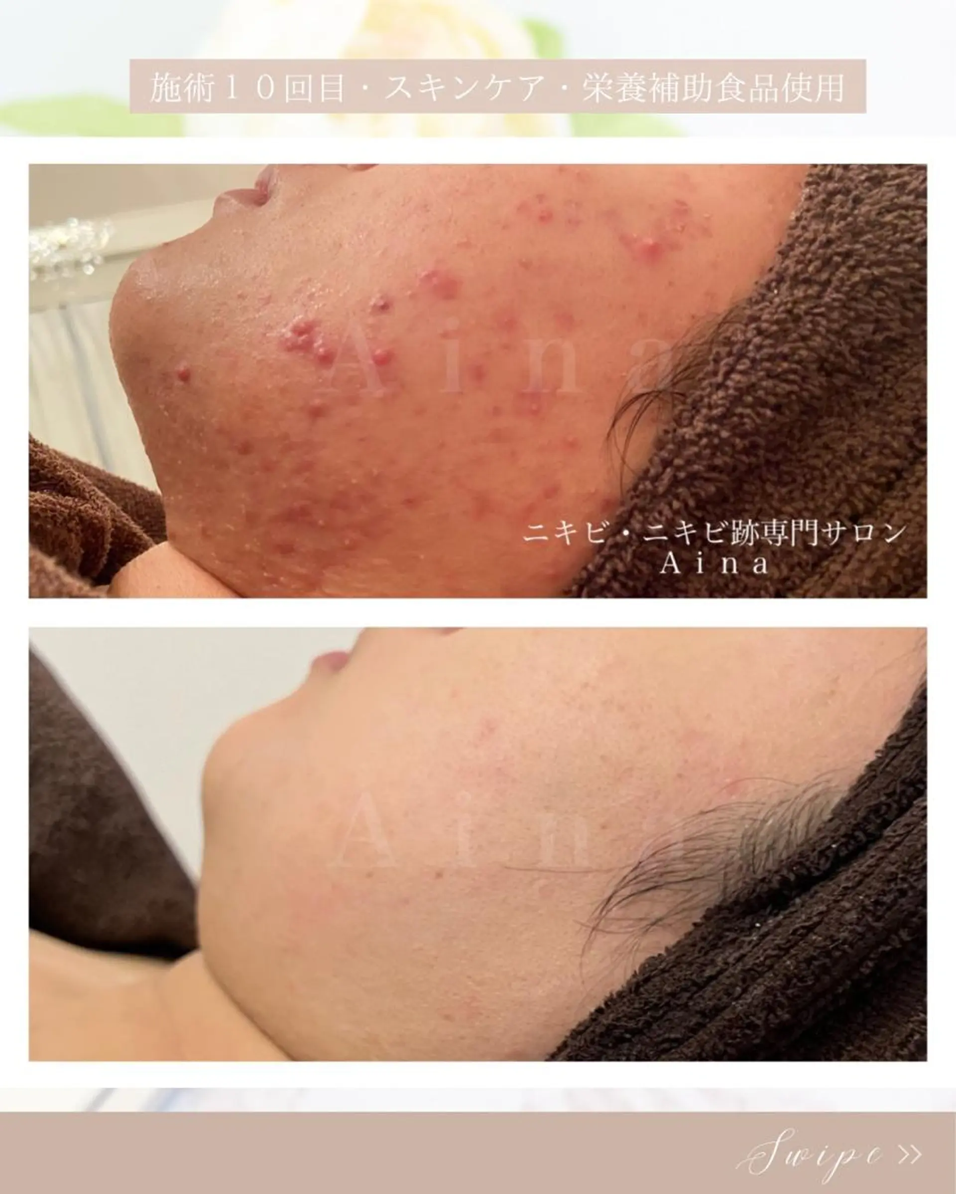 セミロング メンズ キッズ ネイル マツエク・マツパ アイブロウ 赤色 エステ リラク ニキビ跡専門サロン Ａｉｎａのエステ・リラクイメージ