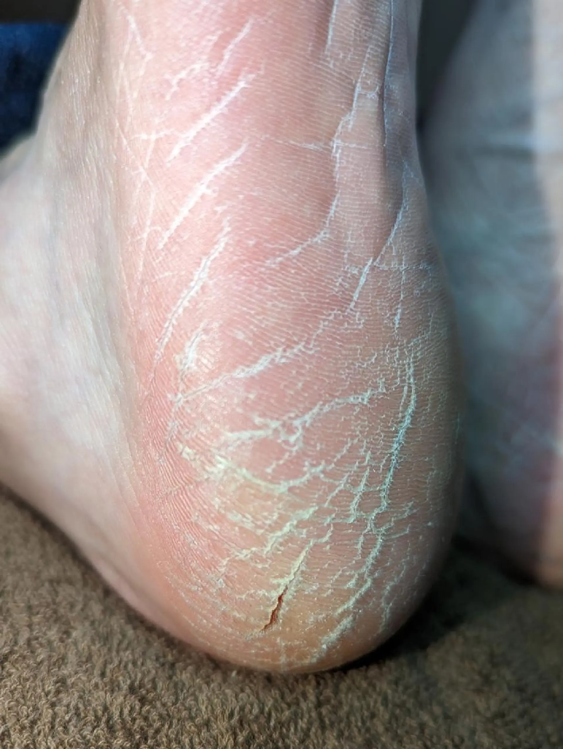 その他 carenail　 tsugumiのその他イメージ