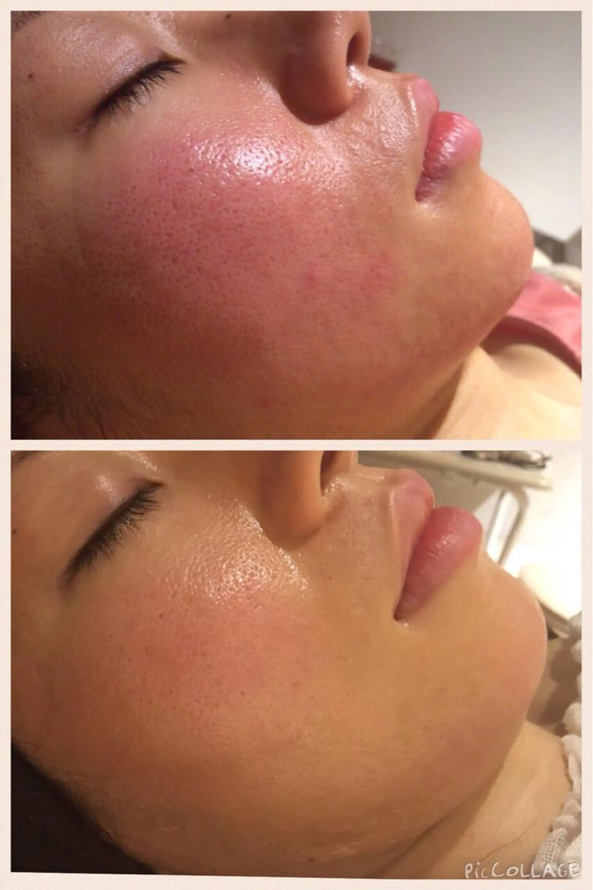 アニメ,Vオタク× 即効痩せエステサロンのエステ・リラクイメージ