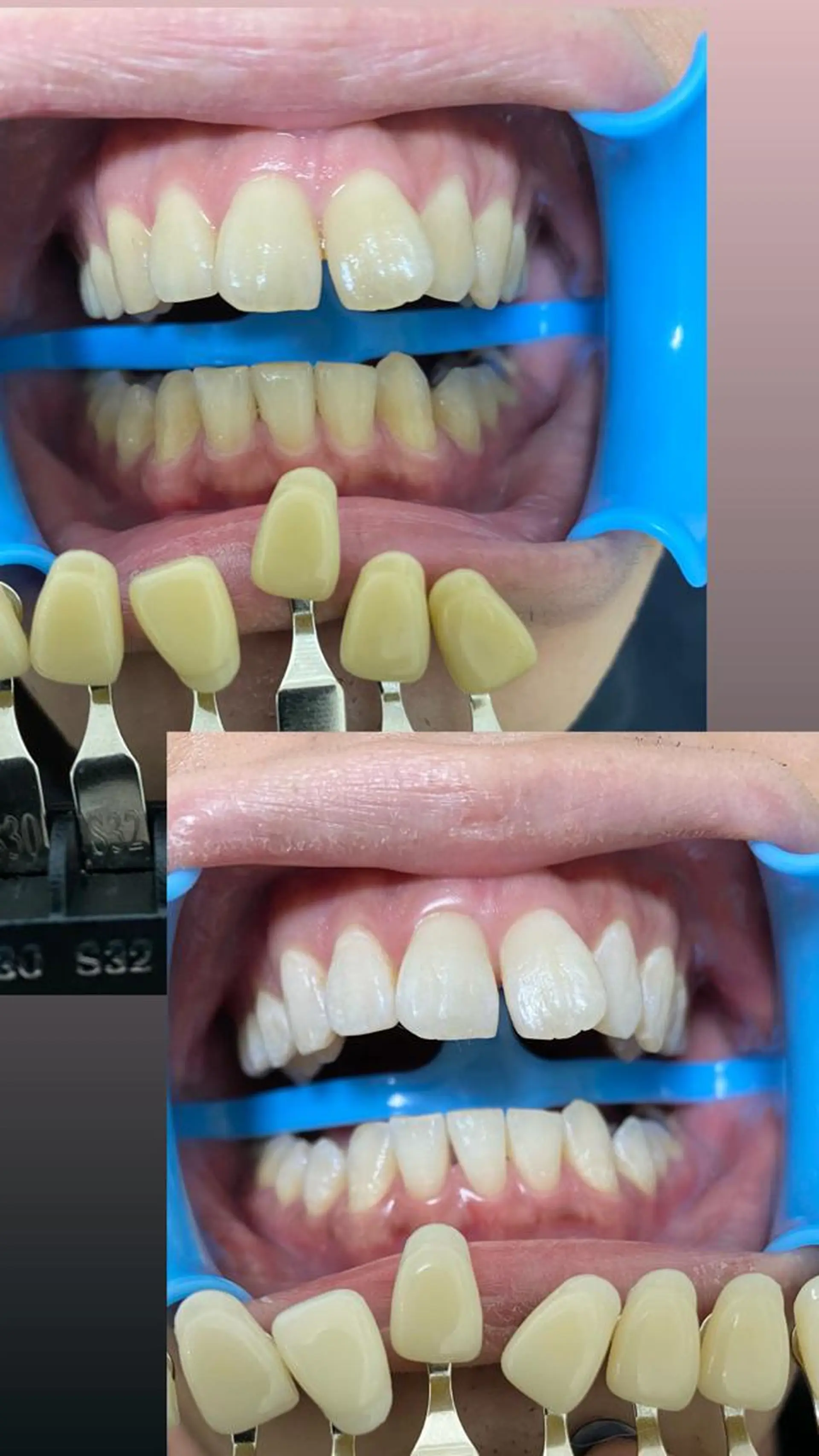 その他 DIA WHITE 奥田のその他イメージ