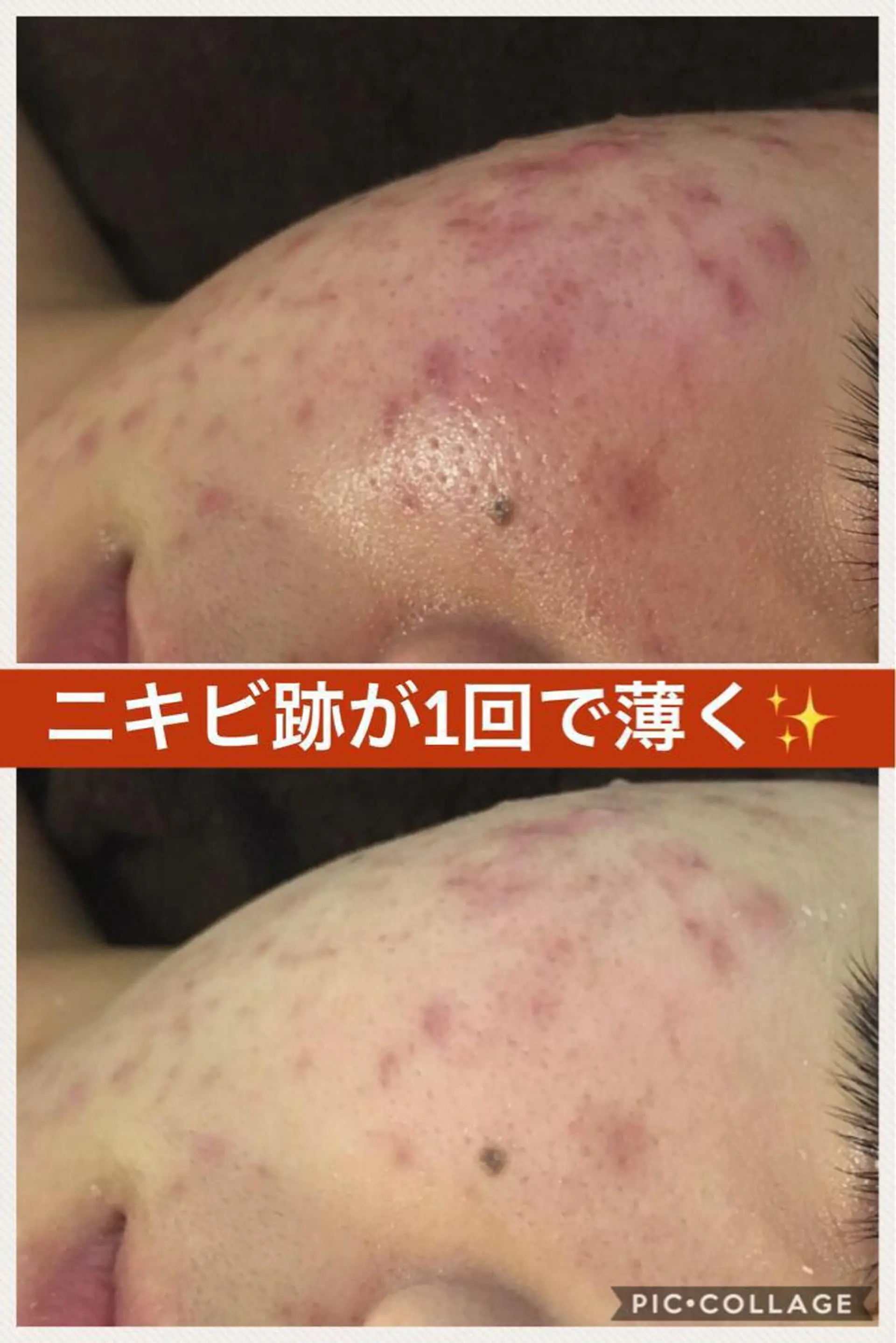 ショート カラー パーマ ヘアアレンジ メンズ キッズ ネイル マツエク・マツパ ニキビ・肌質改善専門 ♡人生が変わるサロンのエステ・リラクイメージ