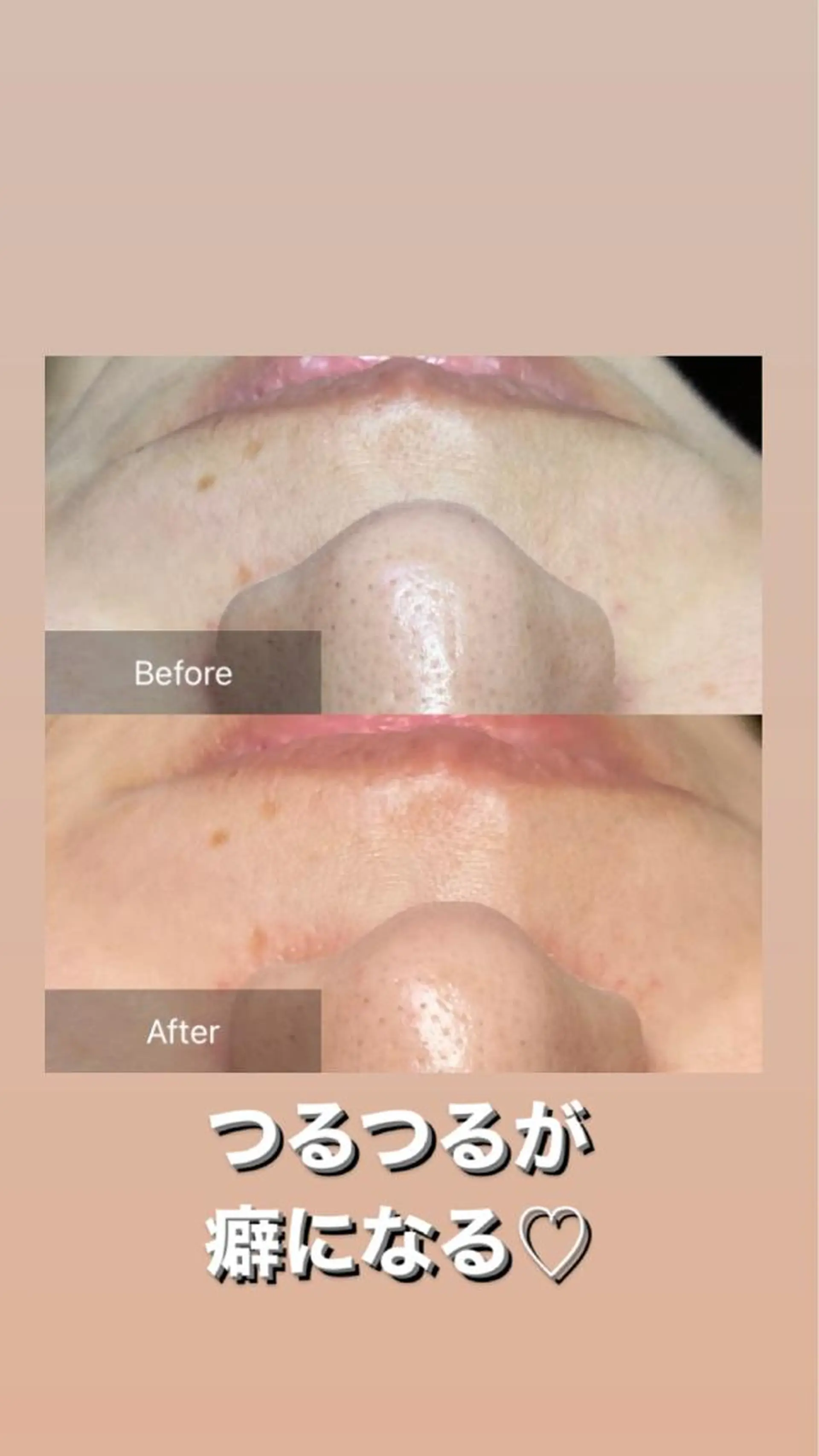 脱毛 産毛専門店 Bittoのエステ・リラクイメージ