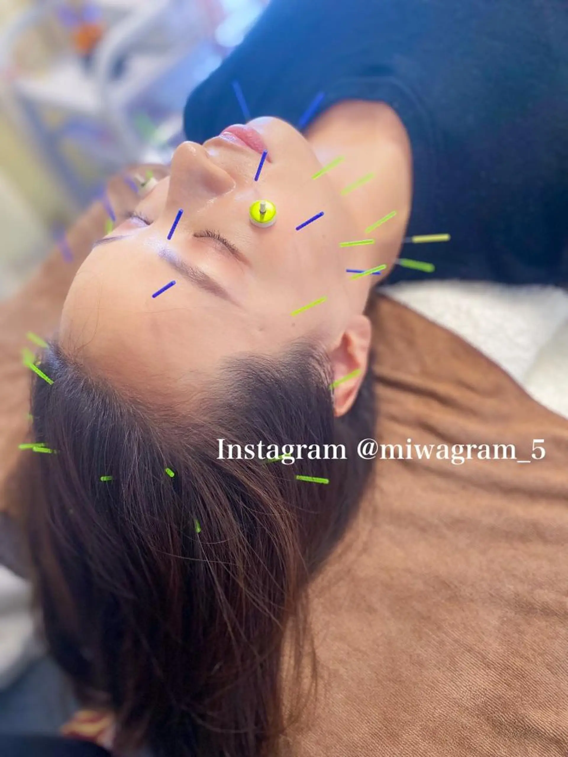 美容鍼灸サロン mahoroba院長のエステ・リラクイメージ