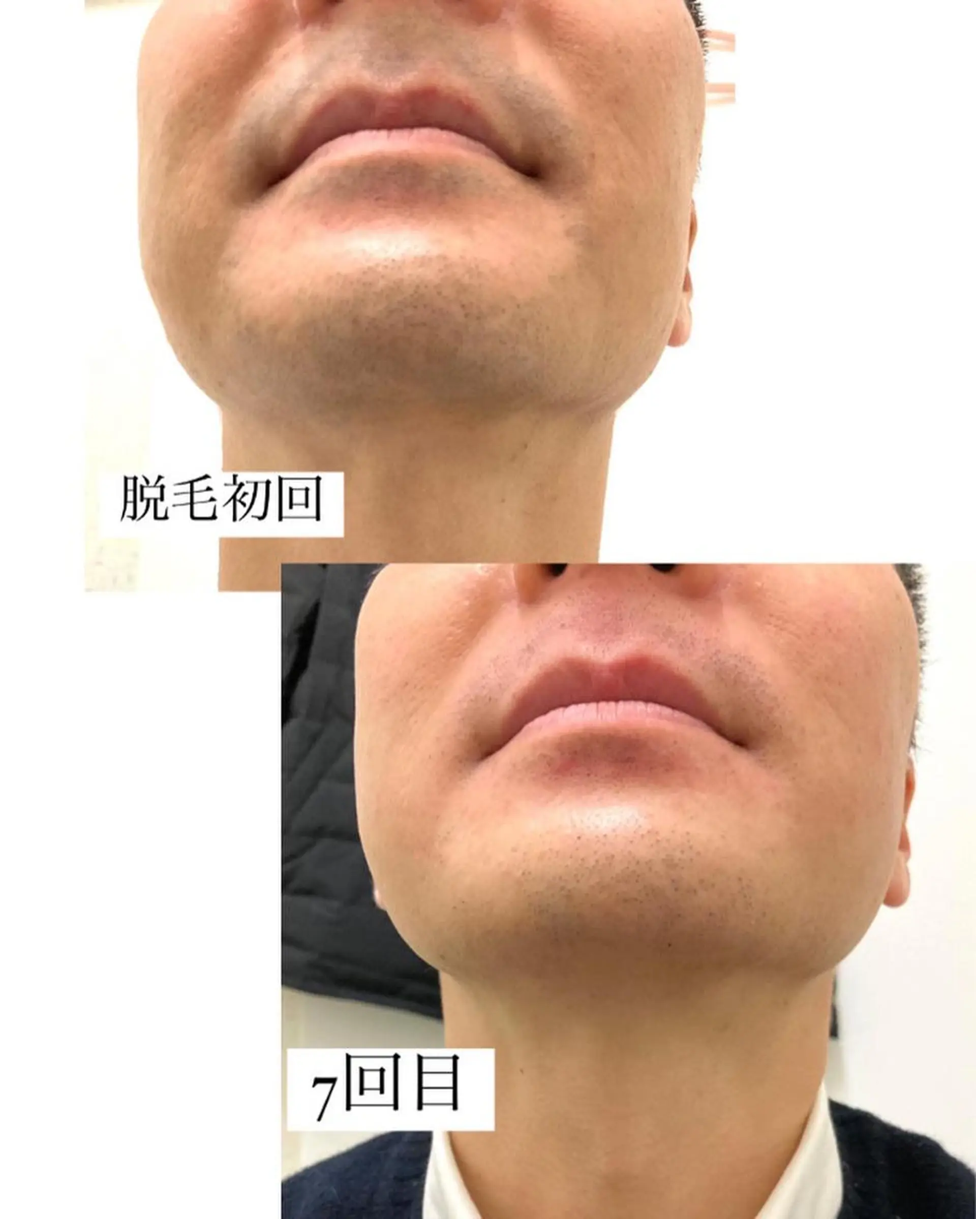 メンズ 脱毛サロン Lilのエステ・リラクイメージ