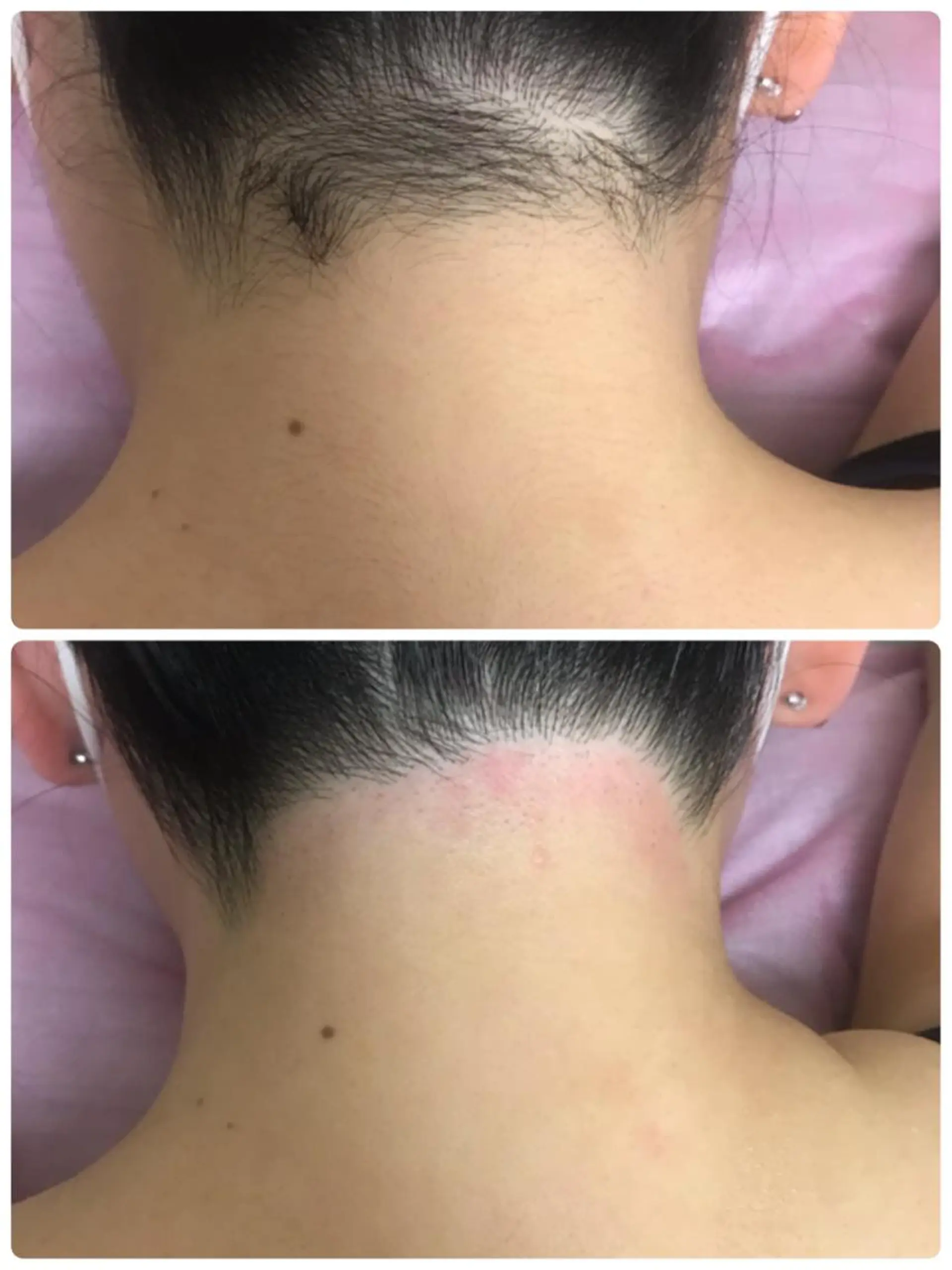 脱毛 MAKANA waxing&relaxation所属・MAKANA 吉岡 小岩店のエステ・リラクイメージ