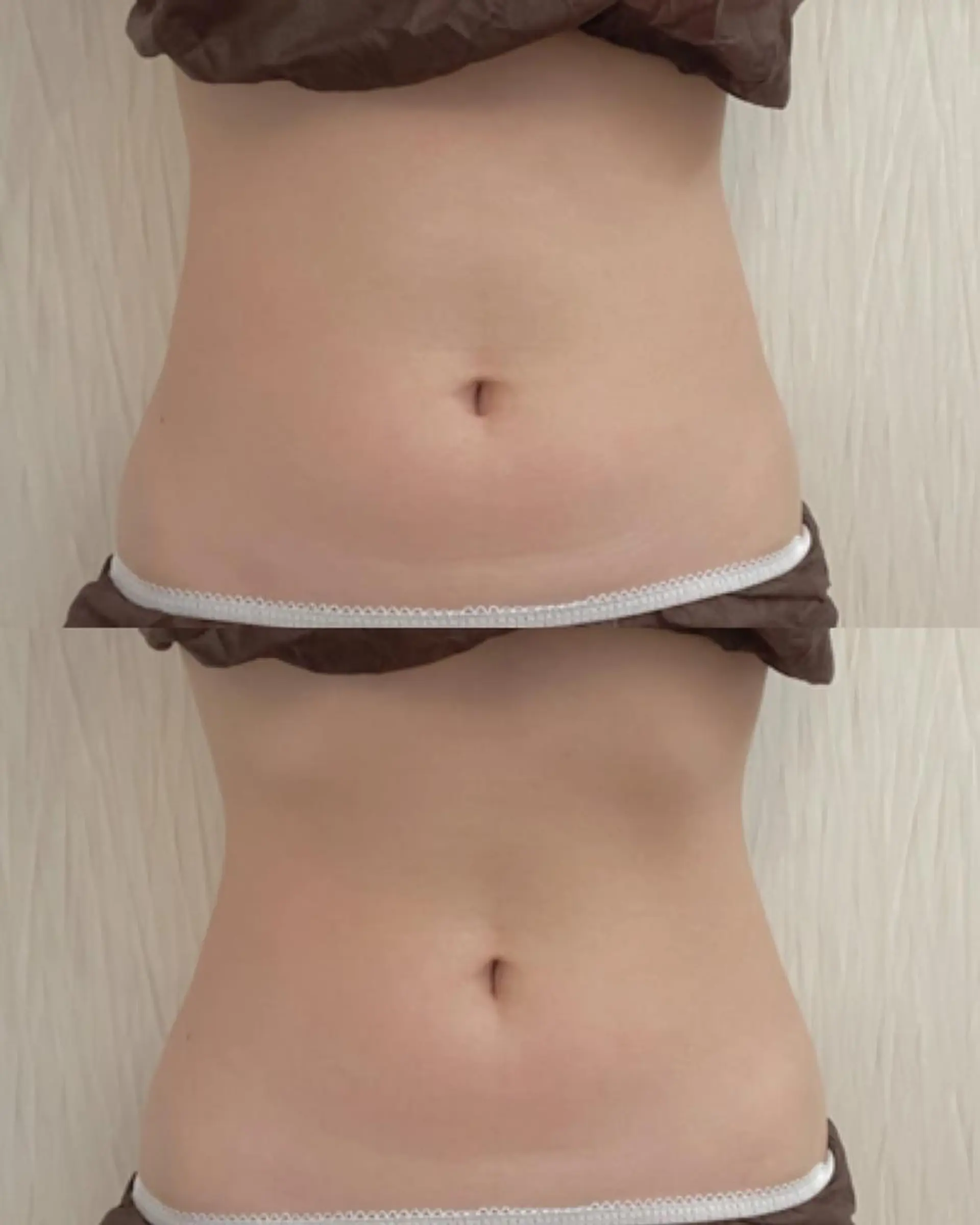 OPREA 栄店のエステ・リラクイメージ