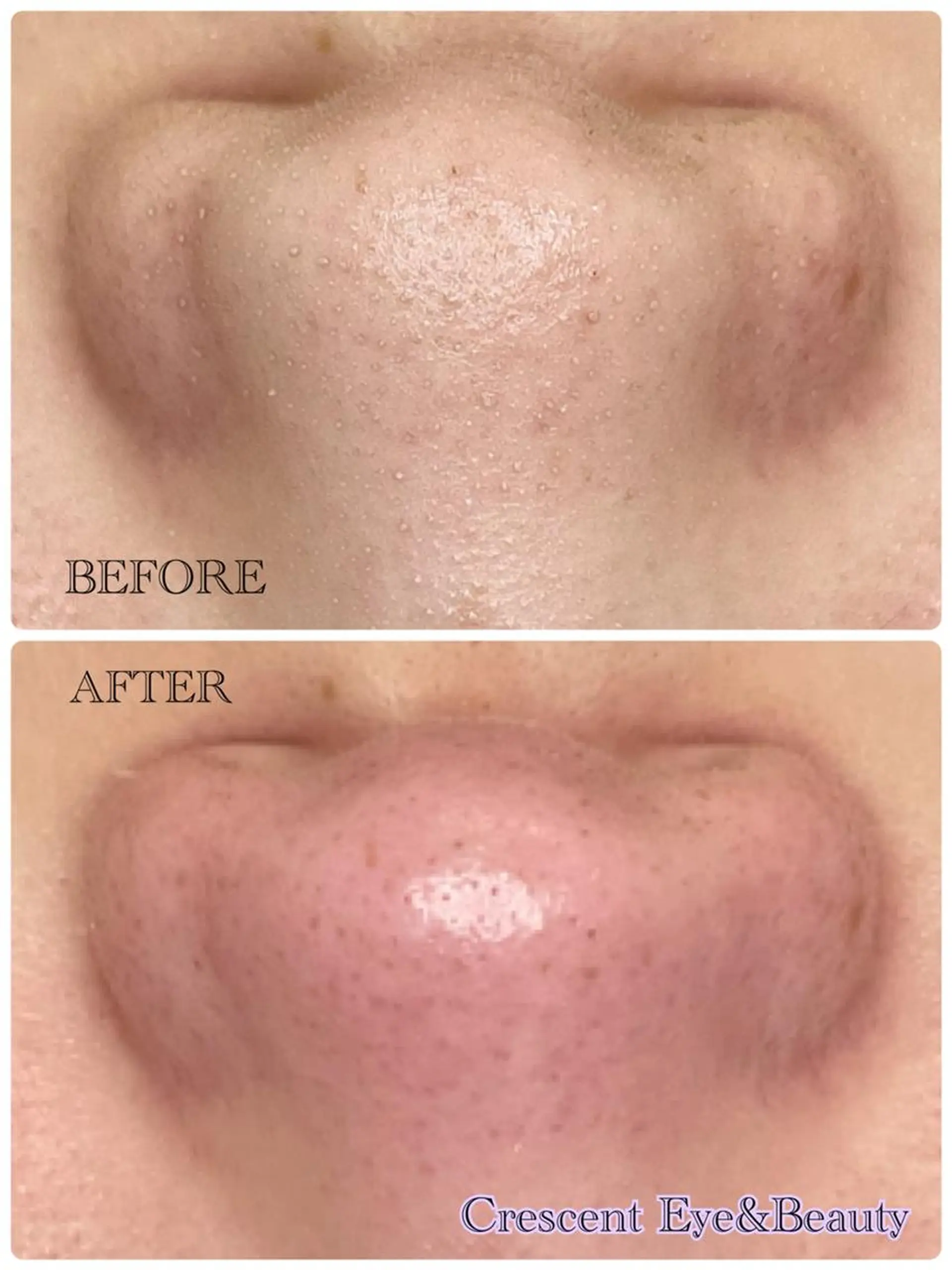 Crescent Beautyのエステ・リラクイメージ