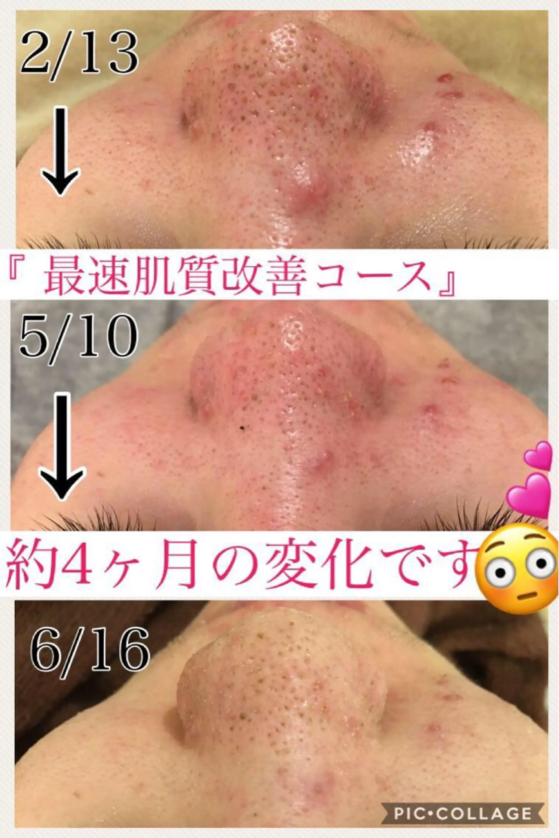 ミディアム カラー パーマ ヘアアレンジ メンズ キッズ ネイル マツエク・マツパ ニキビ・肌質改善専門 ♡人生が変わるサロンのエステ・リラクイメージ