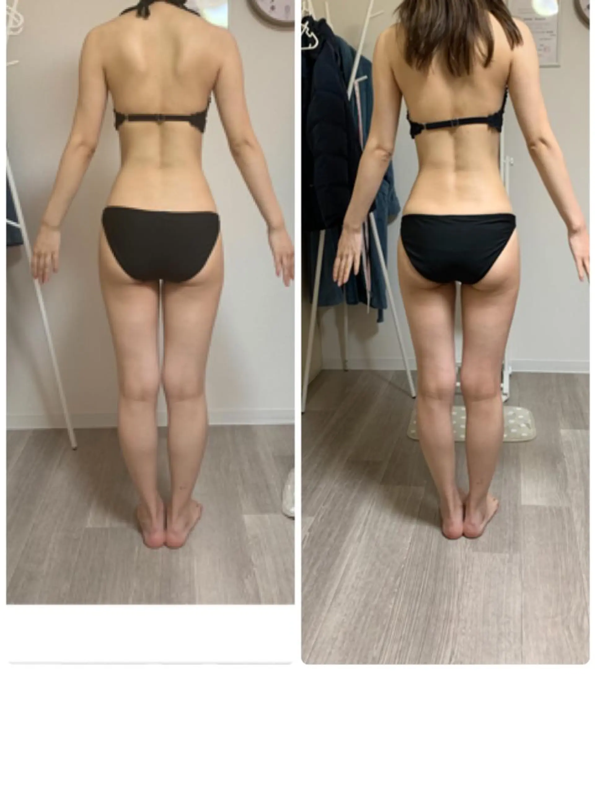 所沢 痩身エステサロンのエステ・リラクイメージ