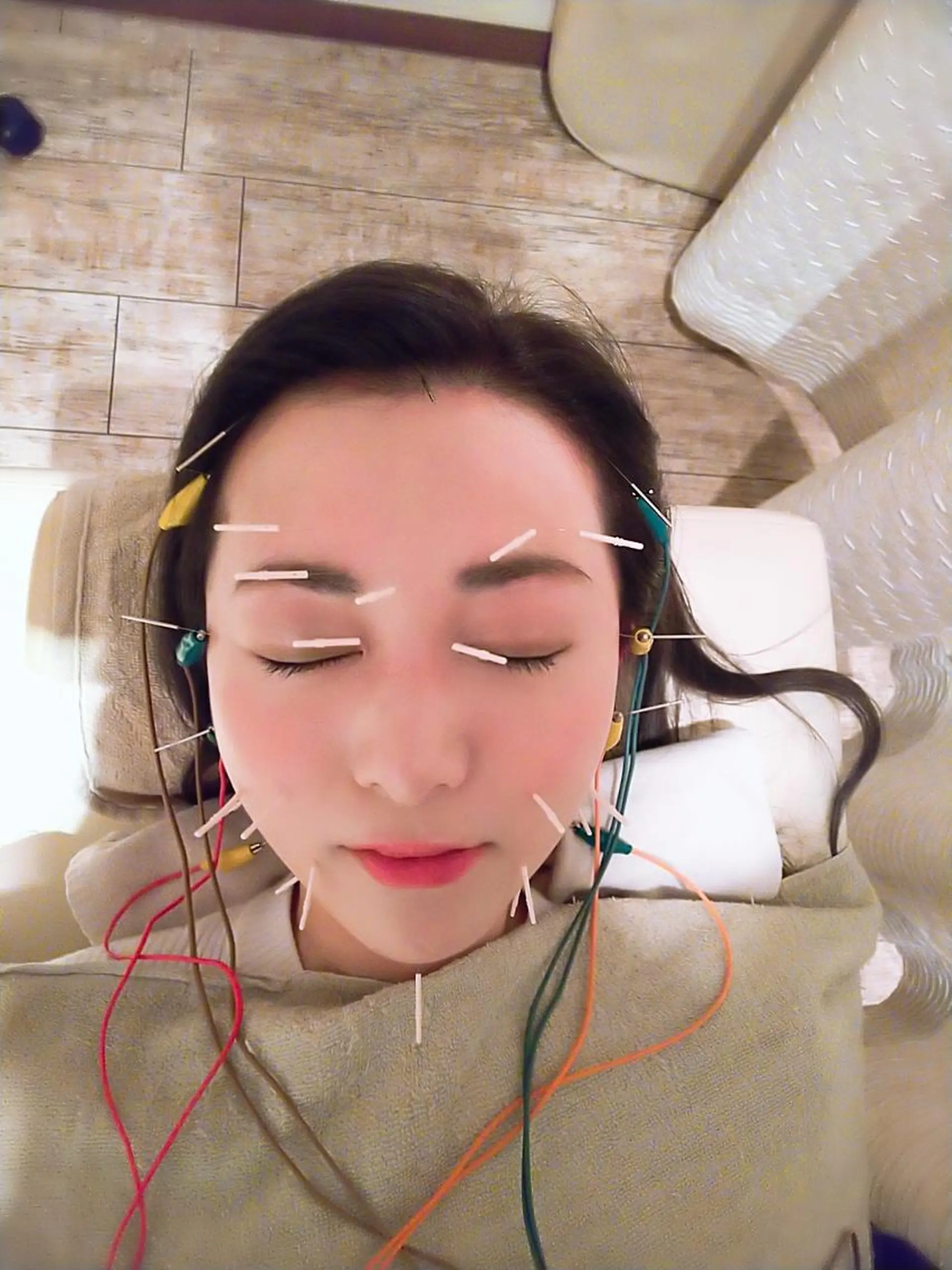 むくみたるみ専門☆ 美容鍼・小顔矯正のエステ・リラクイメージ