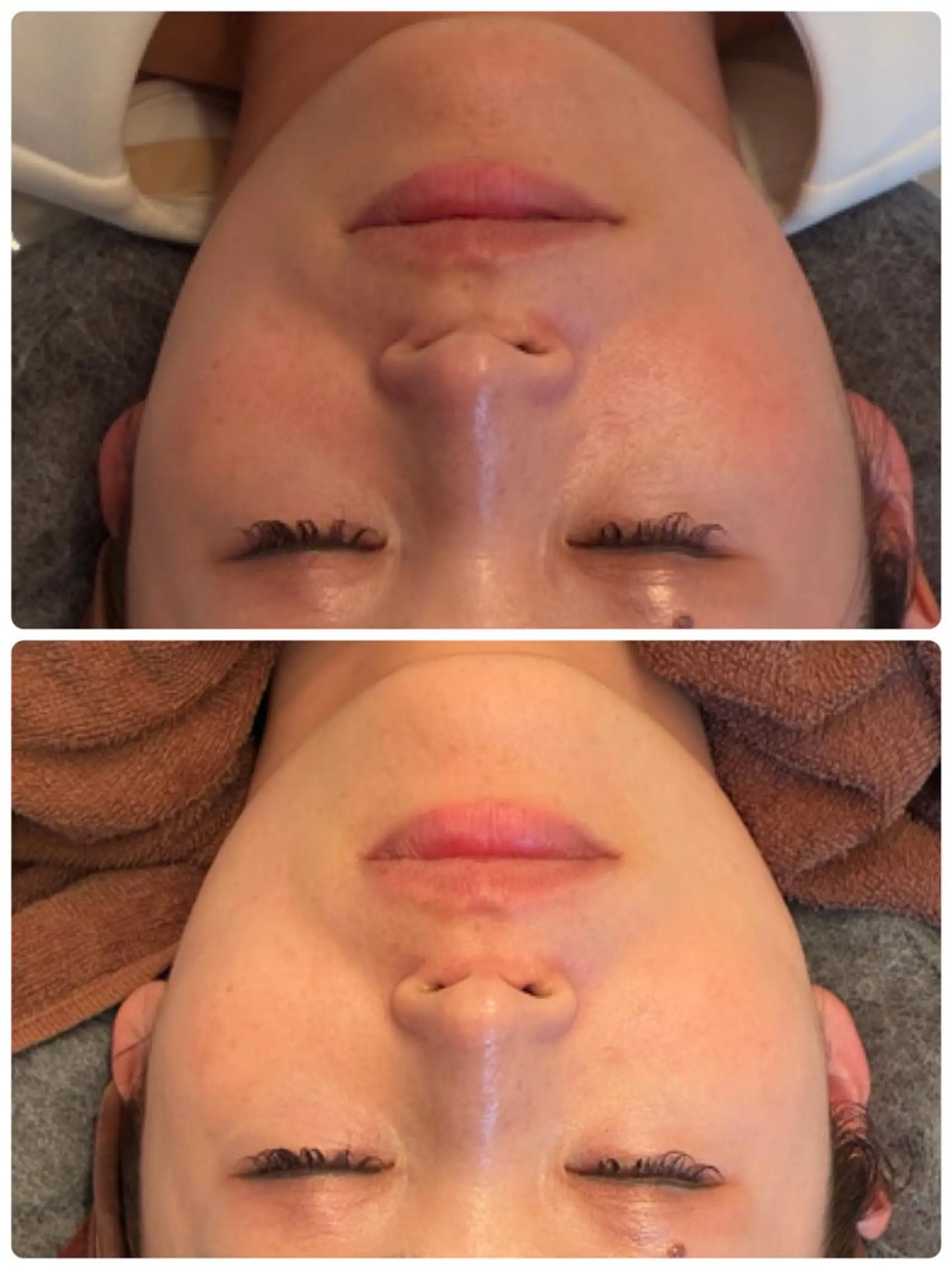 FLEURフェイシャ ル🫧ハーブ🌿小顔のエステ・リラクイメージ