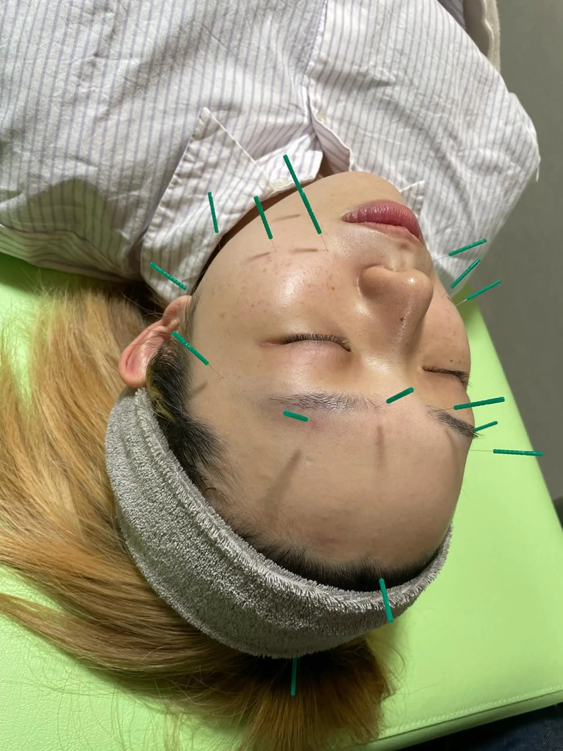 蓮花鍼灸整骨院所属・蓮花鍼灸 整骨院のエステ・リラクイメージ