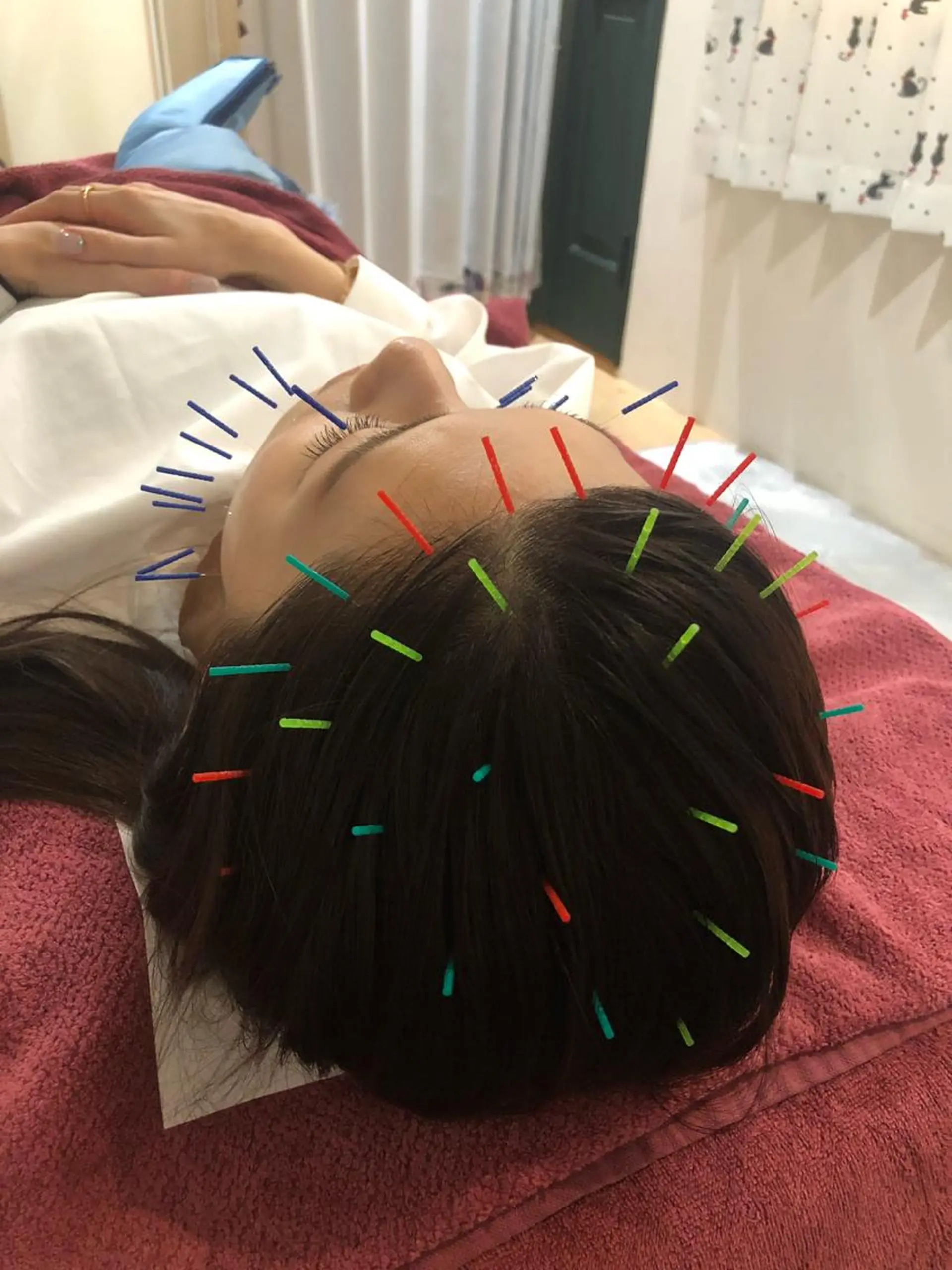 美容鍼灸女性専用 りんご鍼灸治療院のその他イメージ