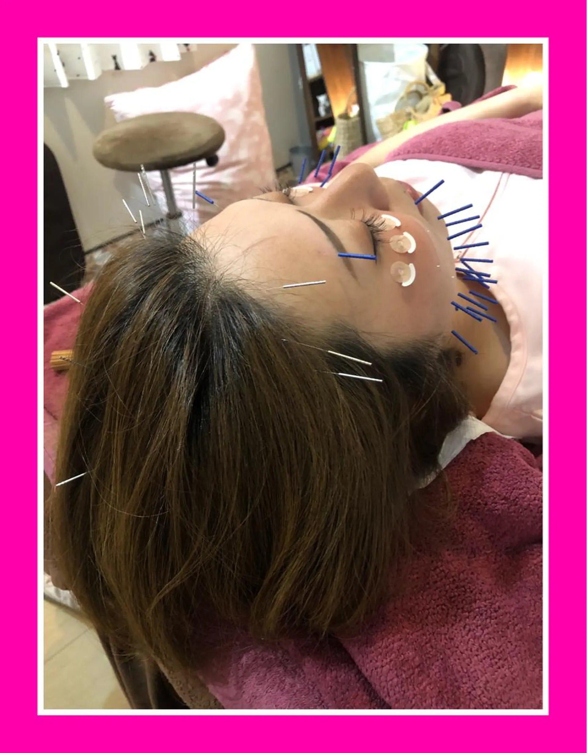 エステ リラク 美容鍼灸女性専用 りんご鍼灸治療院のその他イメージ