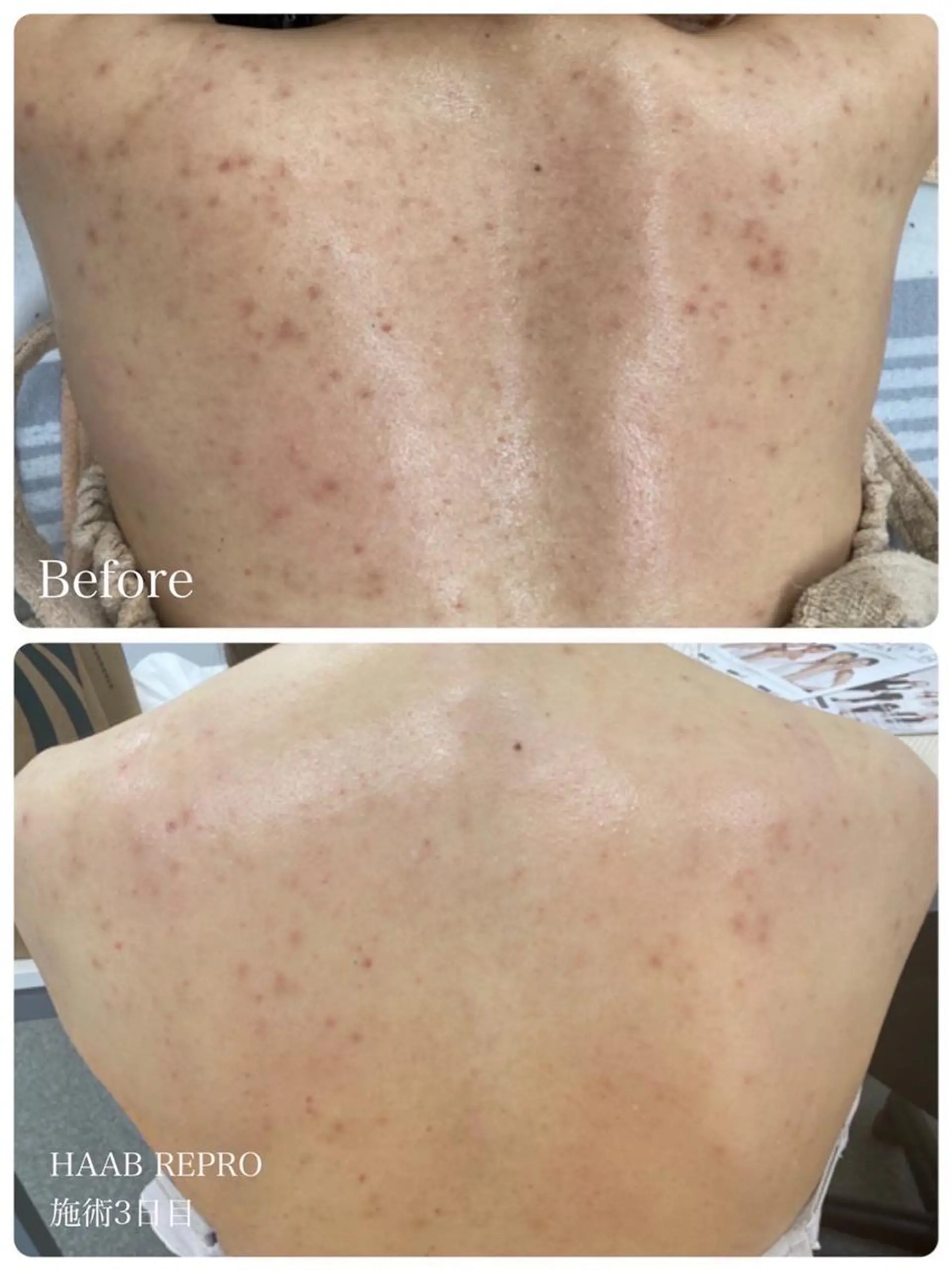 1ヶ月後も半分残る 高持続LEDエクステのマツエク・マツパデザイン