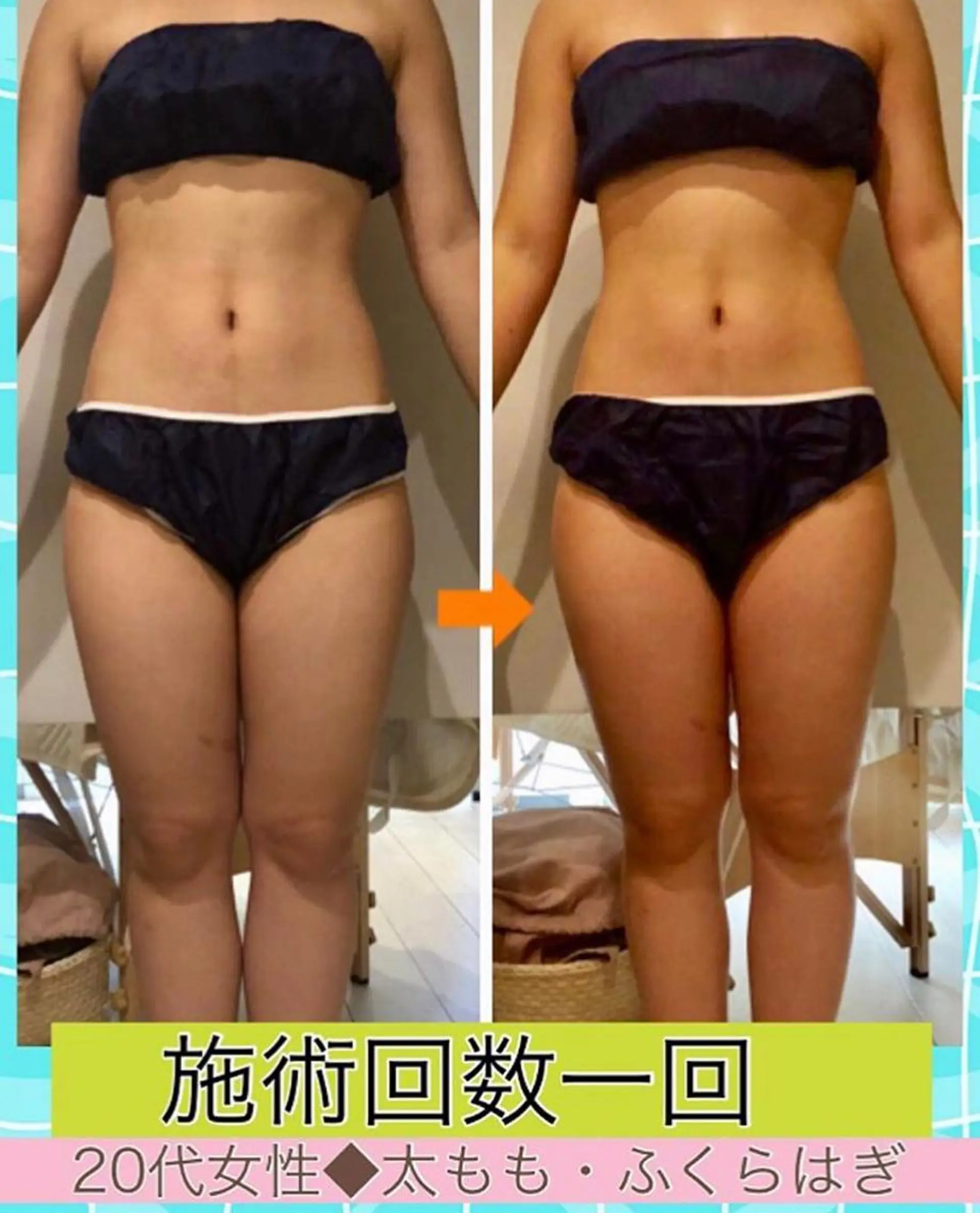 ロング カラー パーマ ヘアアレンジ メンズ キッズ ネイル マツエク・マツパ ‍痩身＆ボディ 結果出し🌟丹野のエステ・リラクイメージ