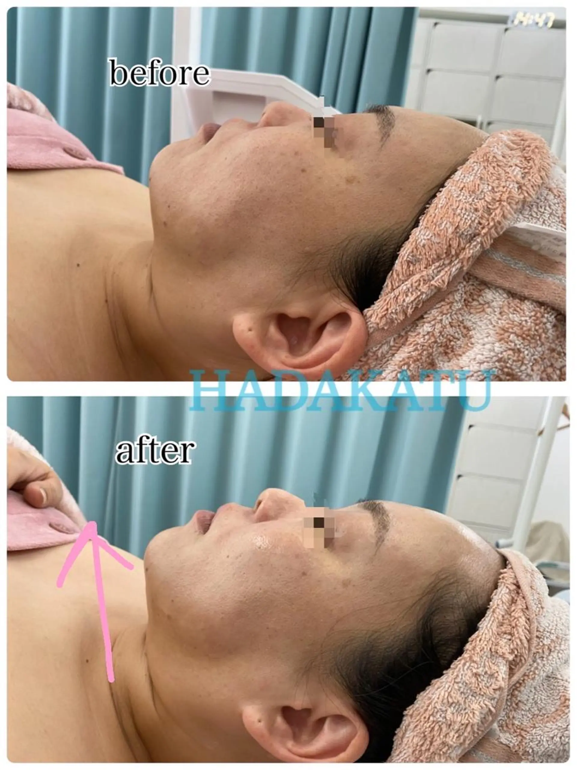 総合エステサロン 肌活のエステ・リラクイメージ