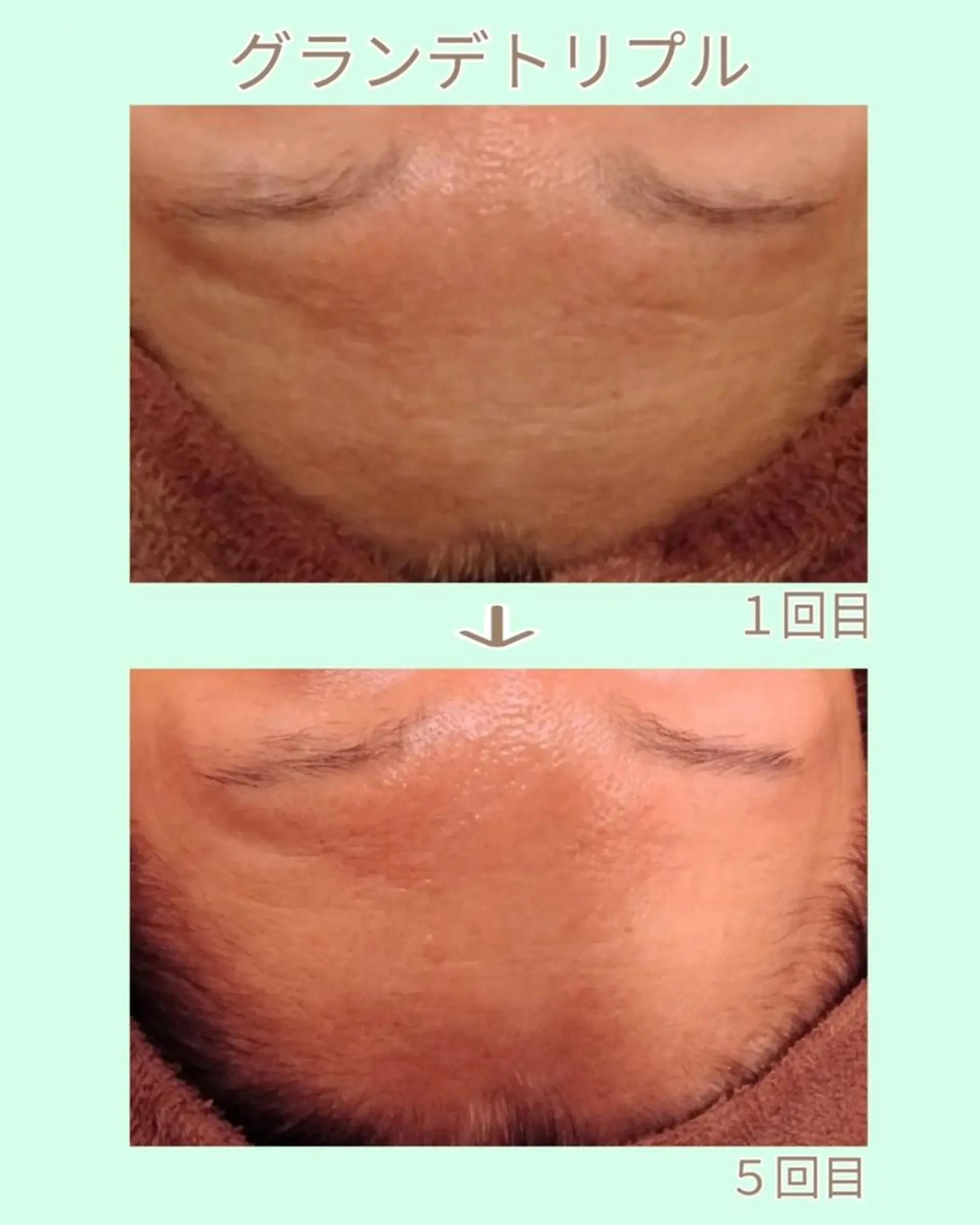 ラブニール 恵比寿店のエステ・リラクイメージ