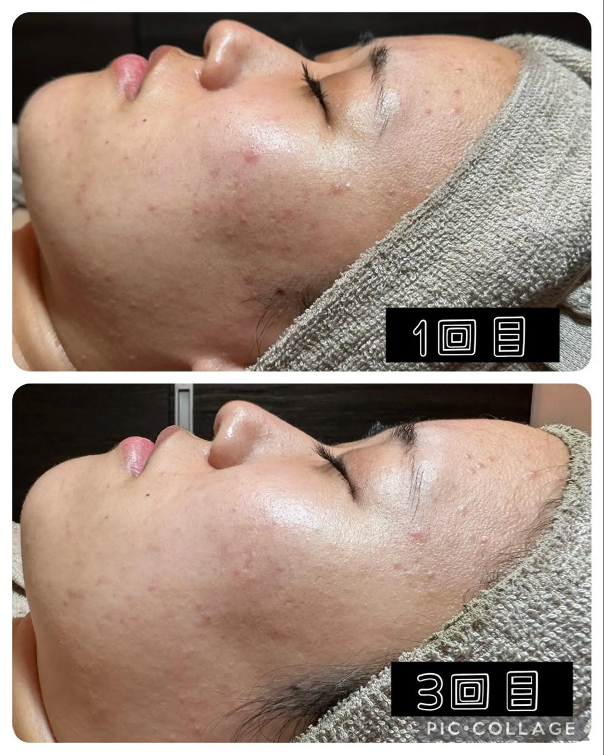 エステ Feel♡ JYURIAのネイルデザイン