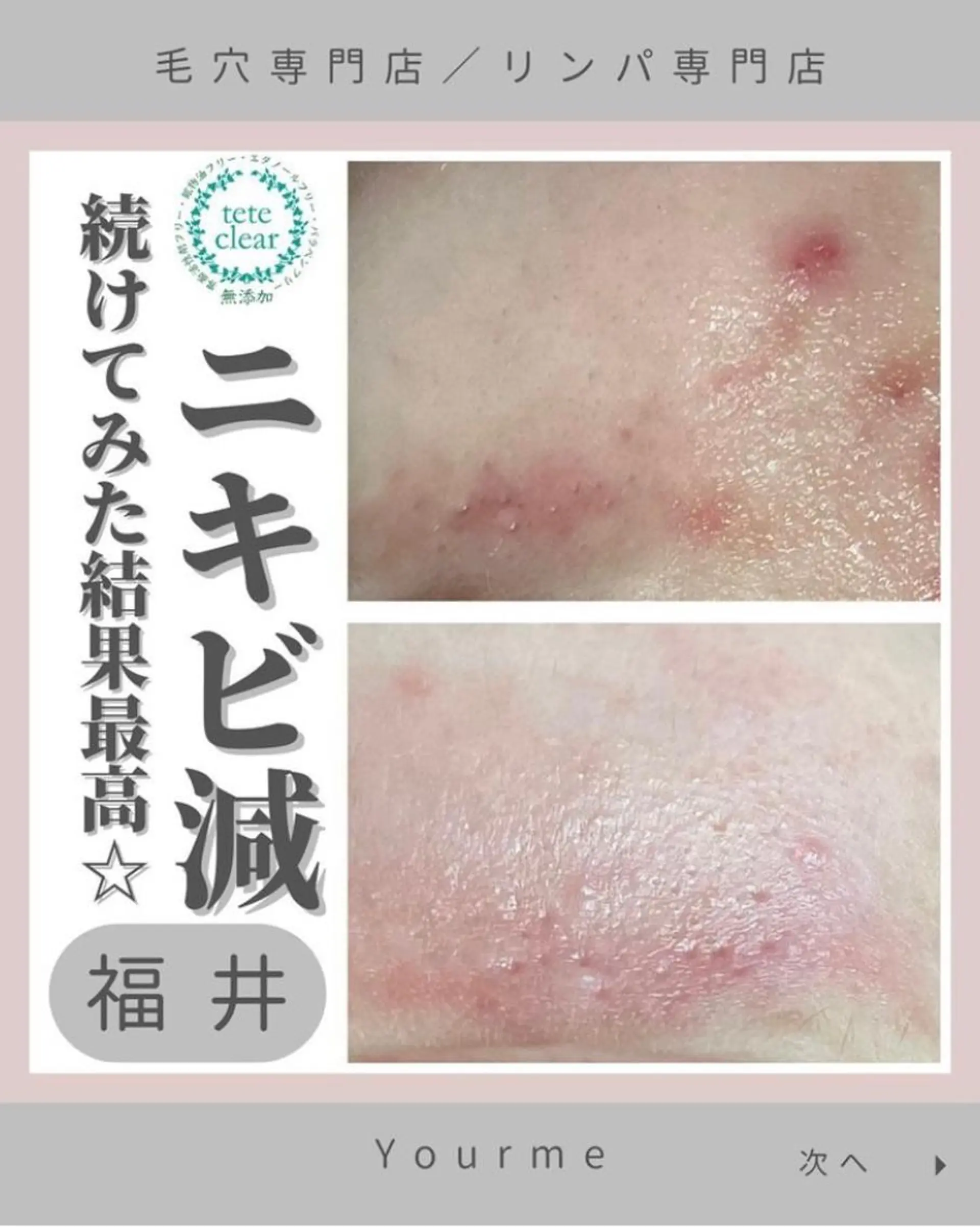 毛穴肌質ケアサロン Yourmeユアミーのエステ・リラクイメージ