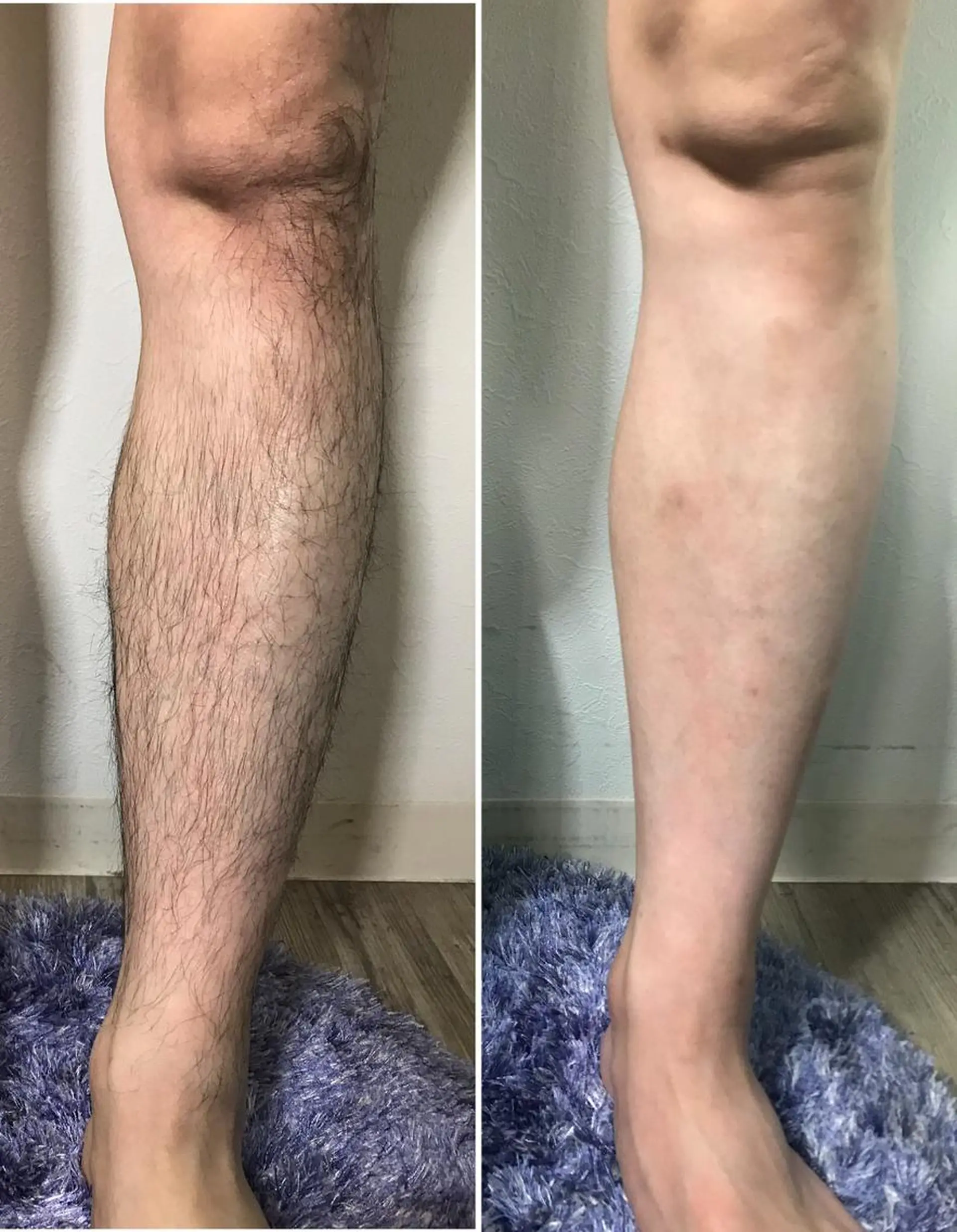 メンズ 脱毛 Lien オーナー 山口智嘉のエステ・リラクイメージ