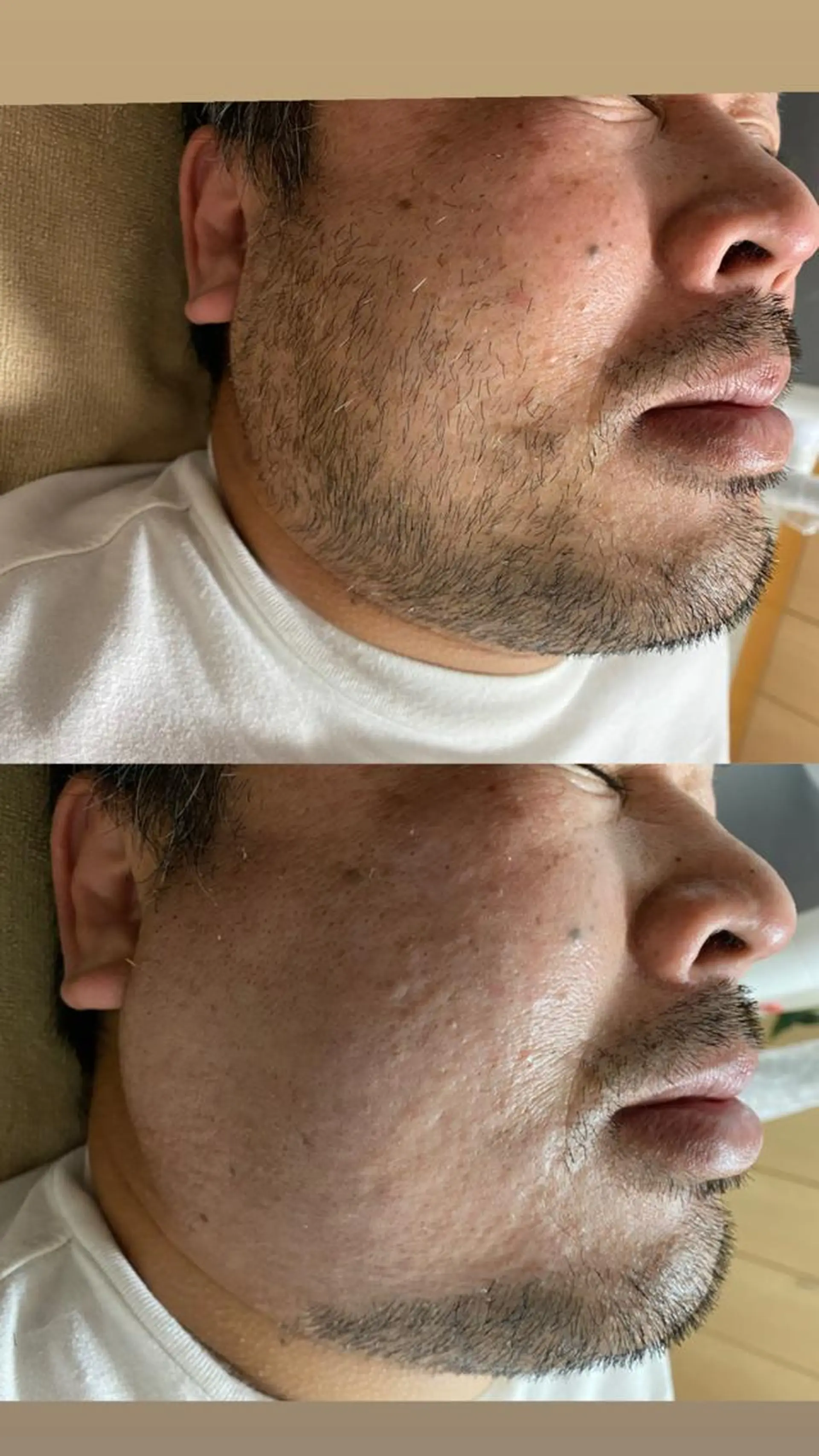 メンズ Epina 千葉店 【エピナ】のエステ・リラクイメージ