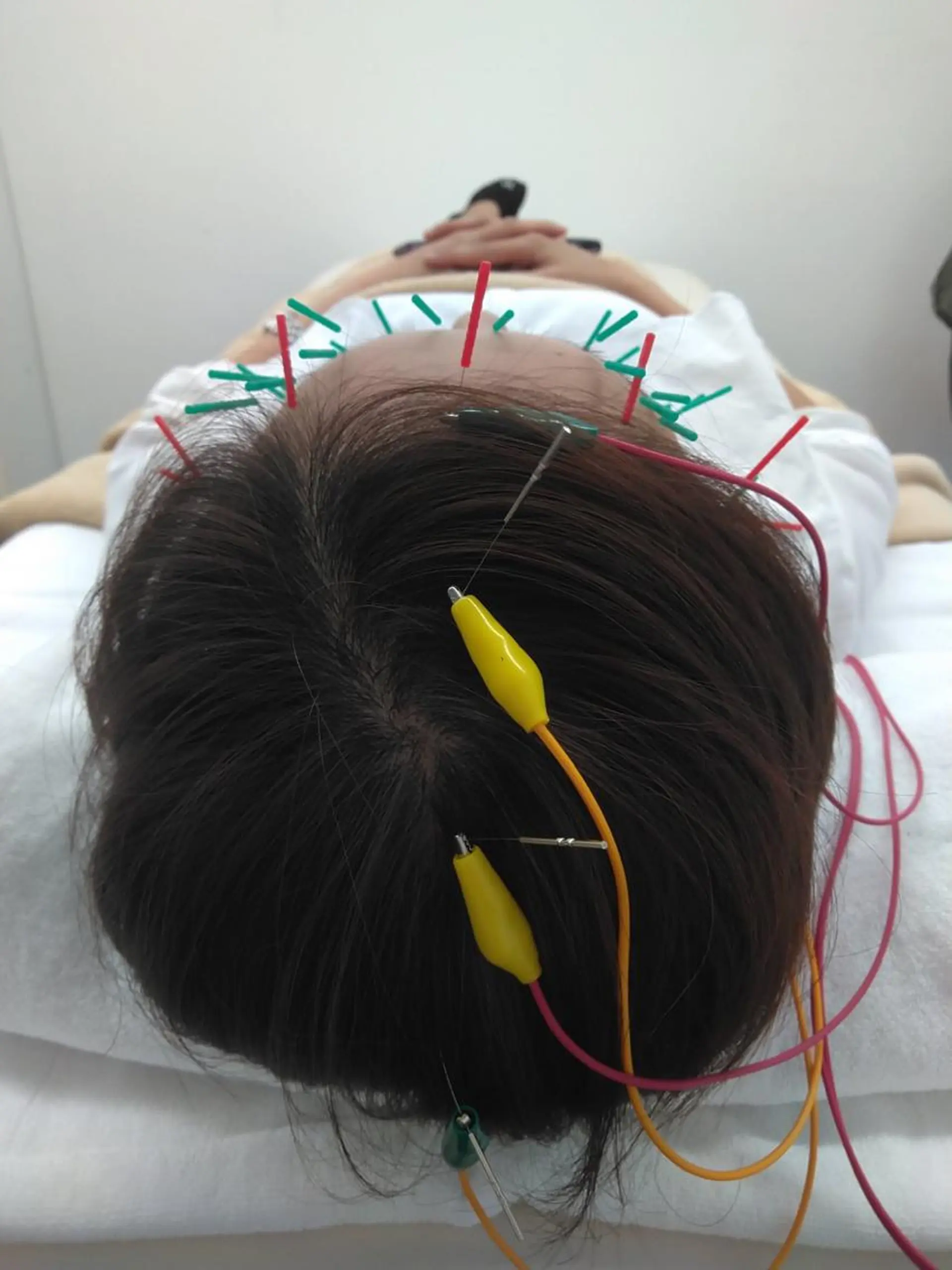 ネイル マツエク・マツパ 美容鍼専門 ハリエンジュのエステ・リラクイメージ