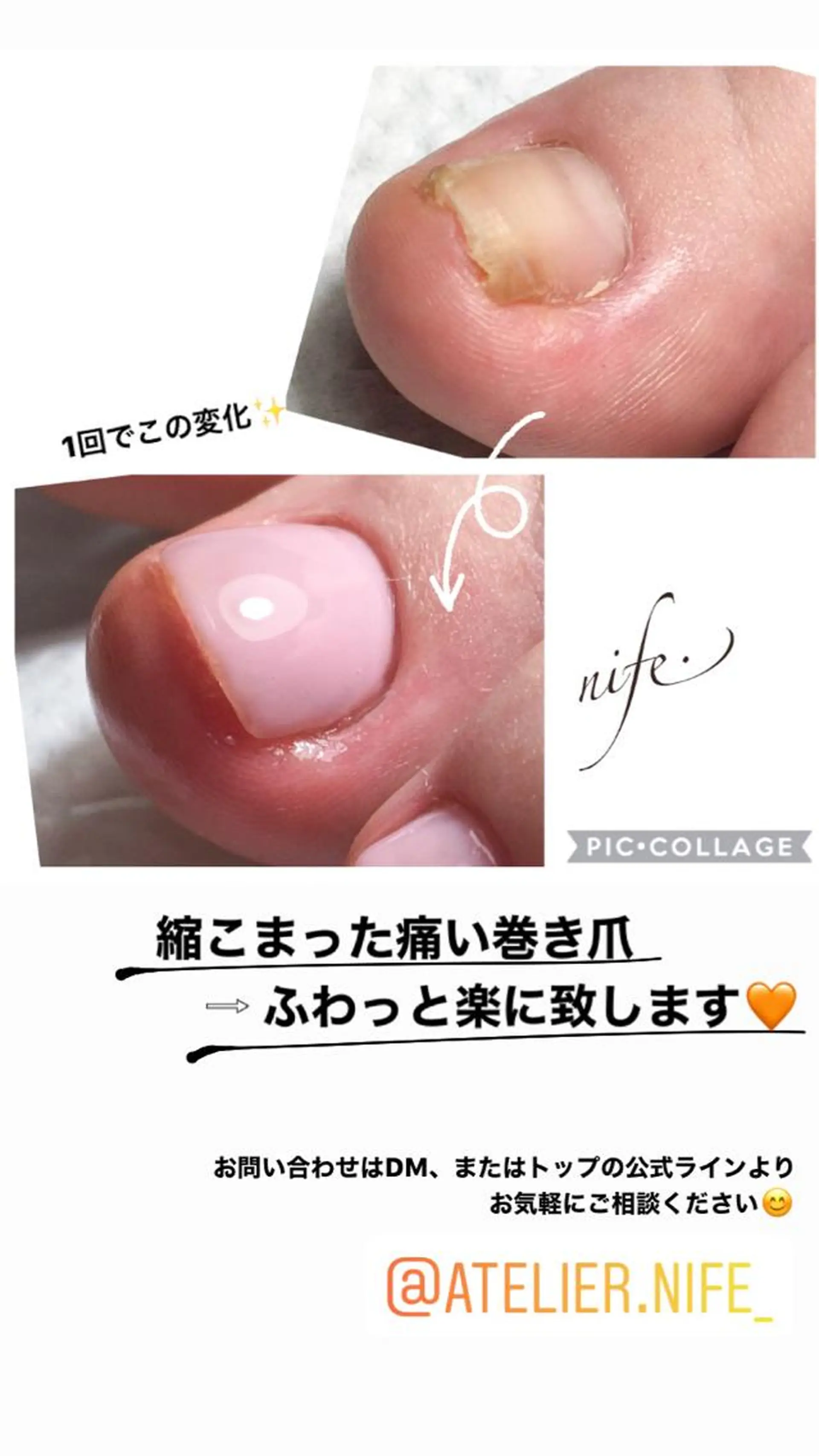 ネイル atelier nife.のネイルデザイン