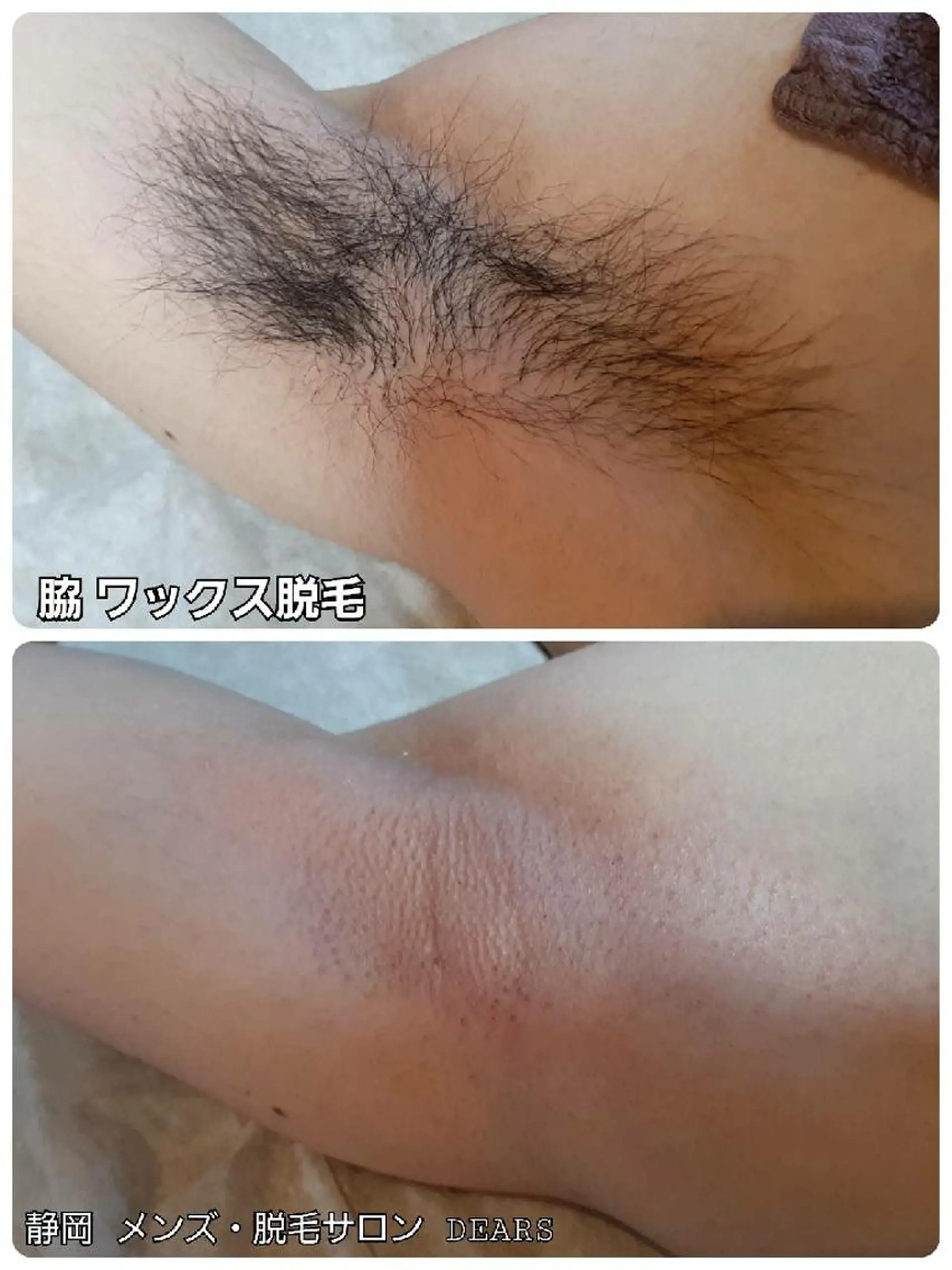 メンズ メンズ・脱毛サロン DEARS所属・山村幸久 メンズ脱毛 ディアーズのエステ・リラクイメージ