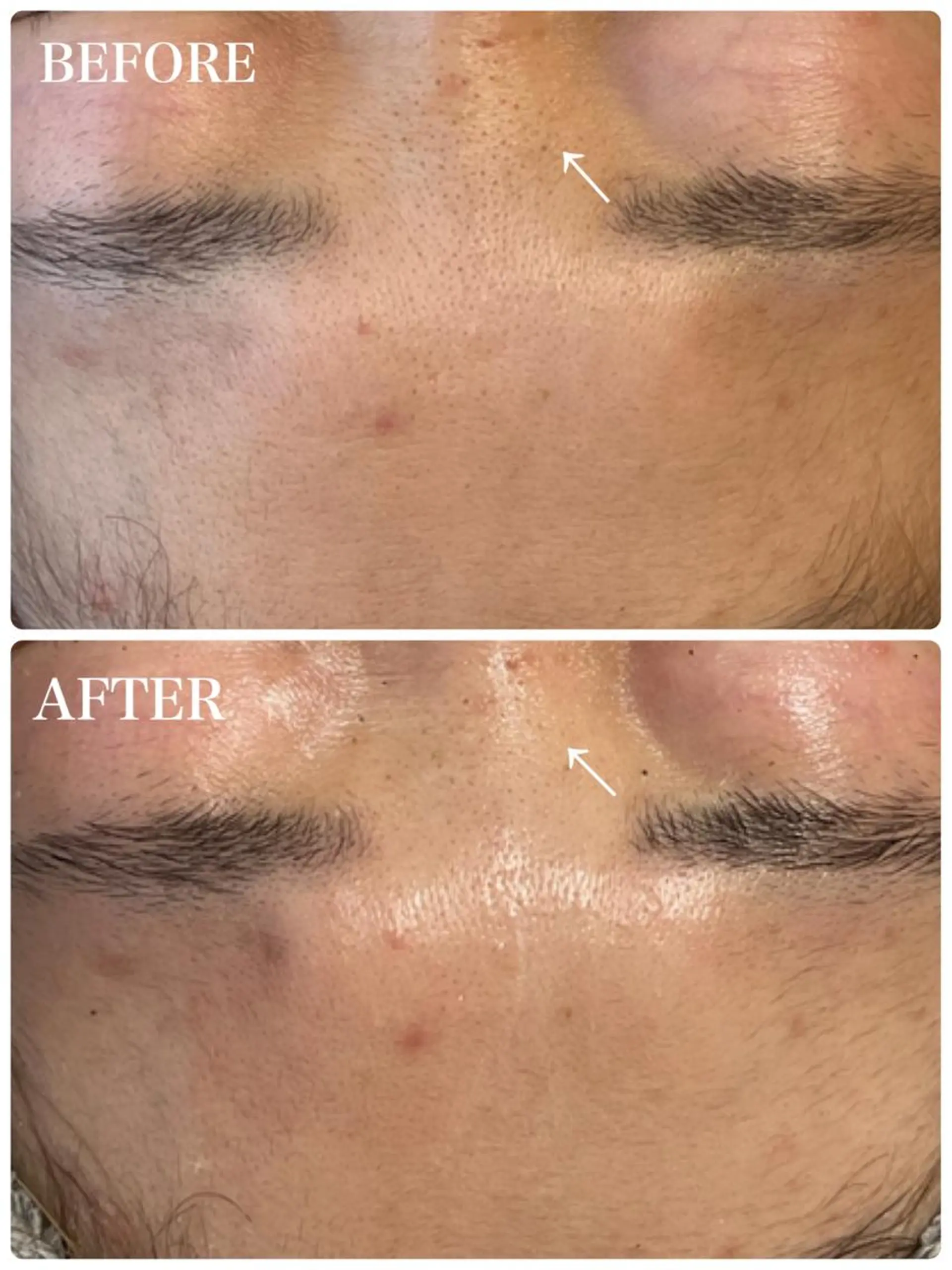 GULLIG söt GULLIGのネイルデザイン