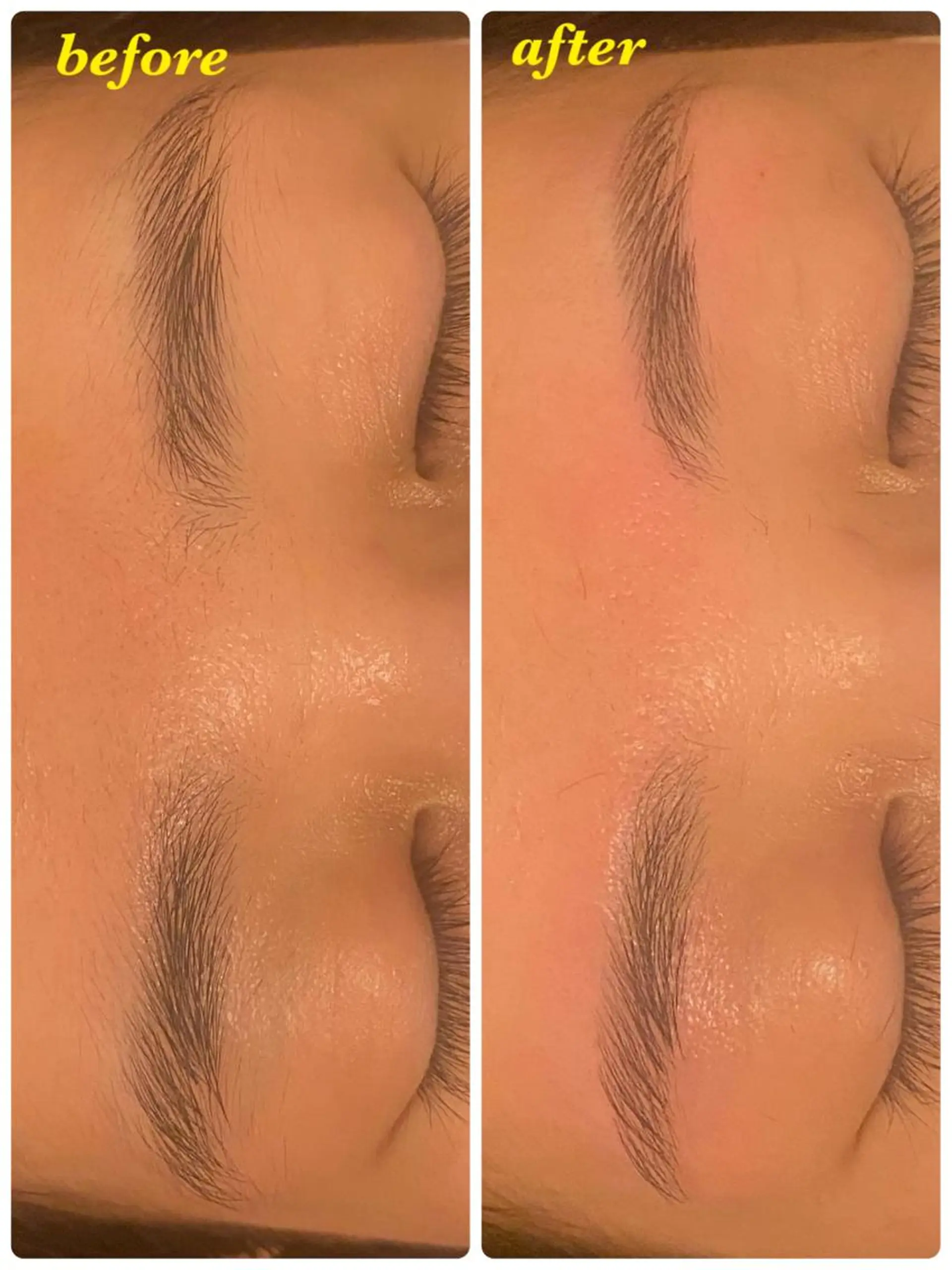 アイブロウ ハーブピーリング/韓国肌管理/フェイシャル/毛穴洗浄/眉毛/顔脱毛【糸脱毛専門】rev所属・ハーブピーリング専門 毛穴洗浄❤️眉waxのエステ・リラクイメージ