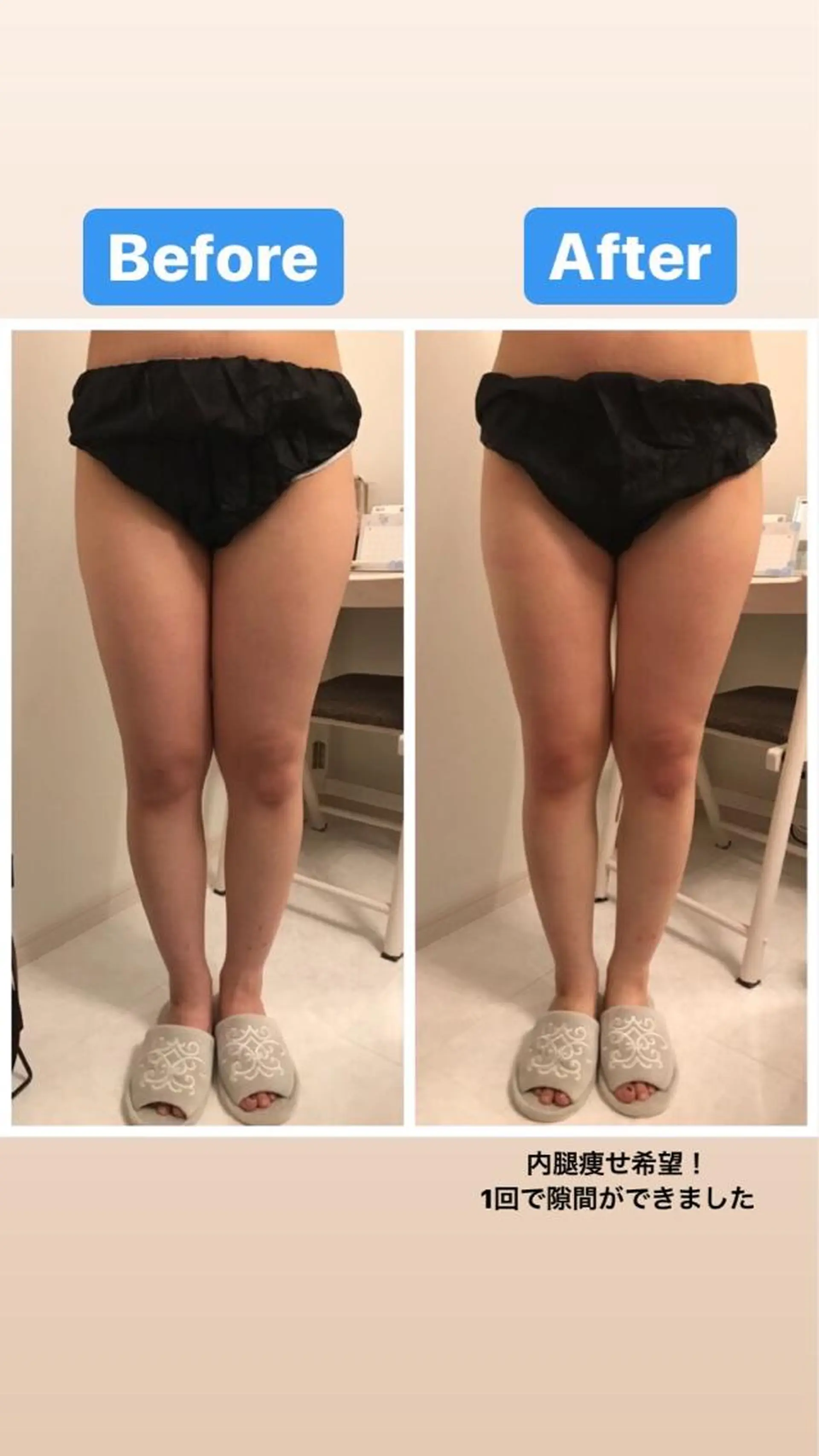 エステ 佐藤 加奈のエステ・リラクイメージ