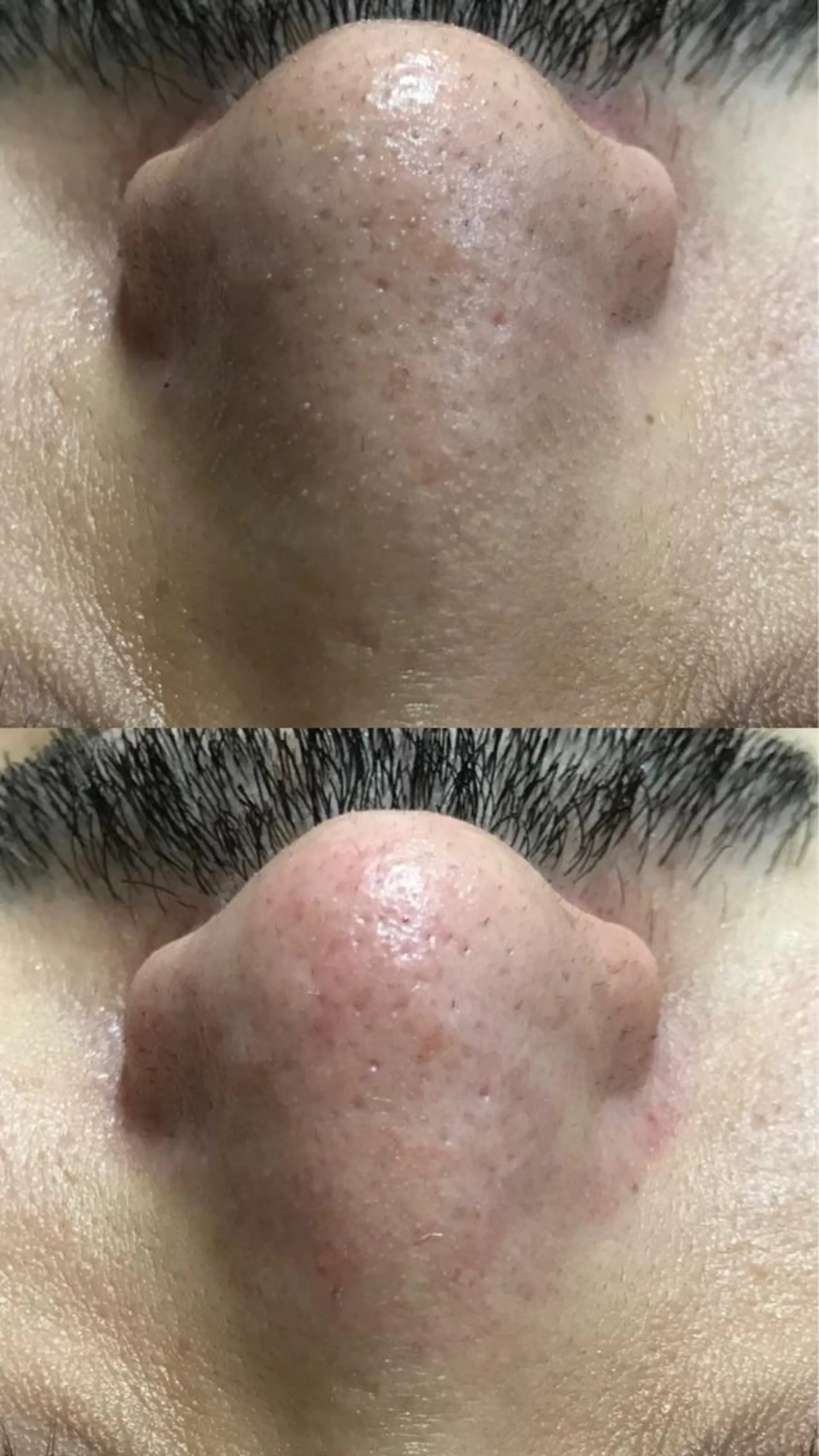 Lilyboo 星のエステ・リラクイメージ