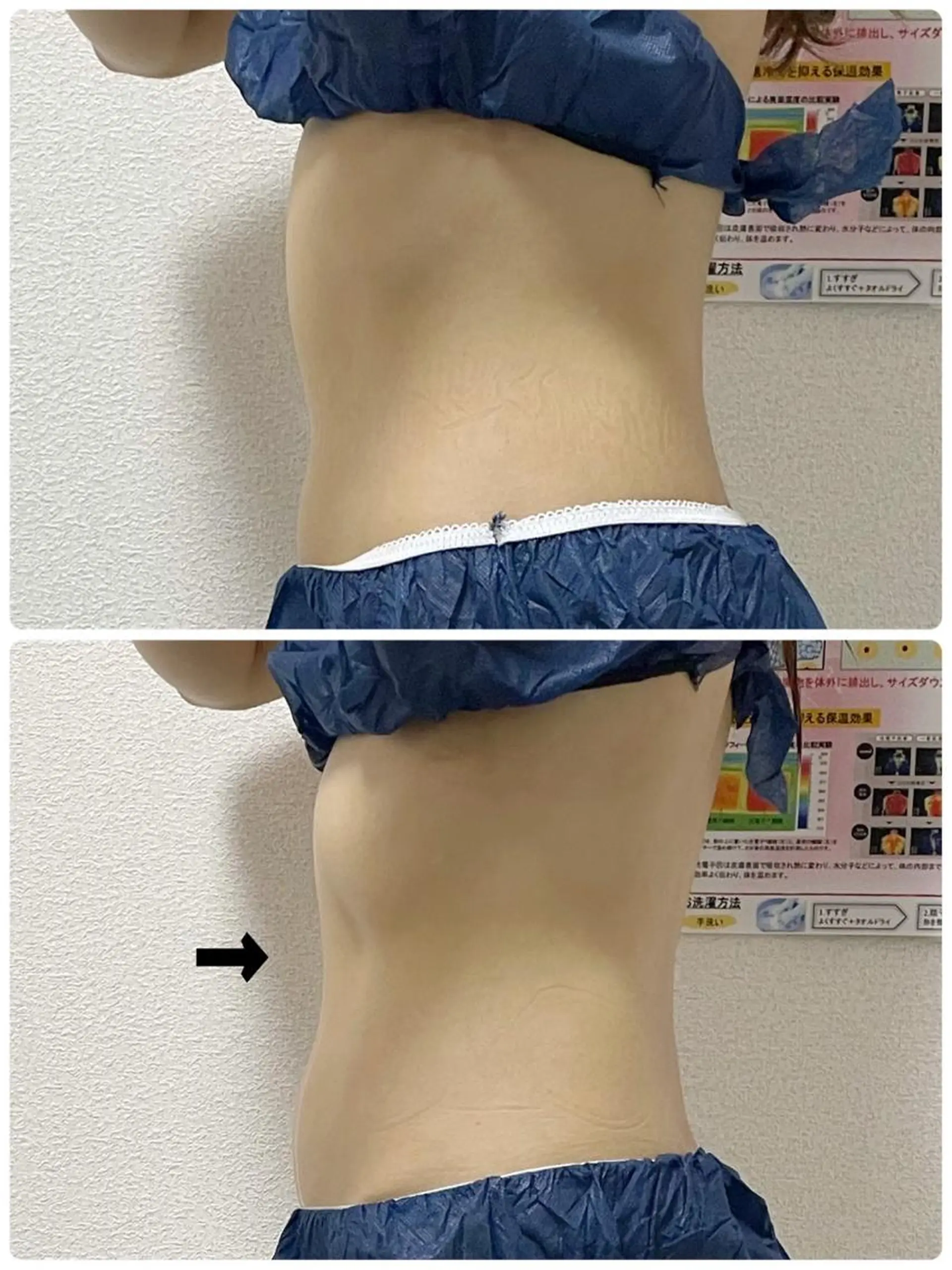 エステ 古山 由美子のその他イメージ