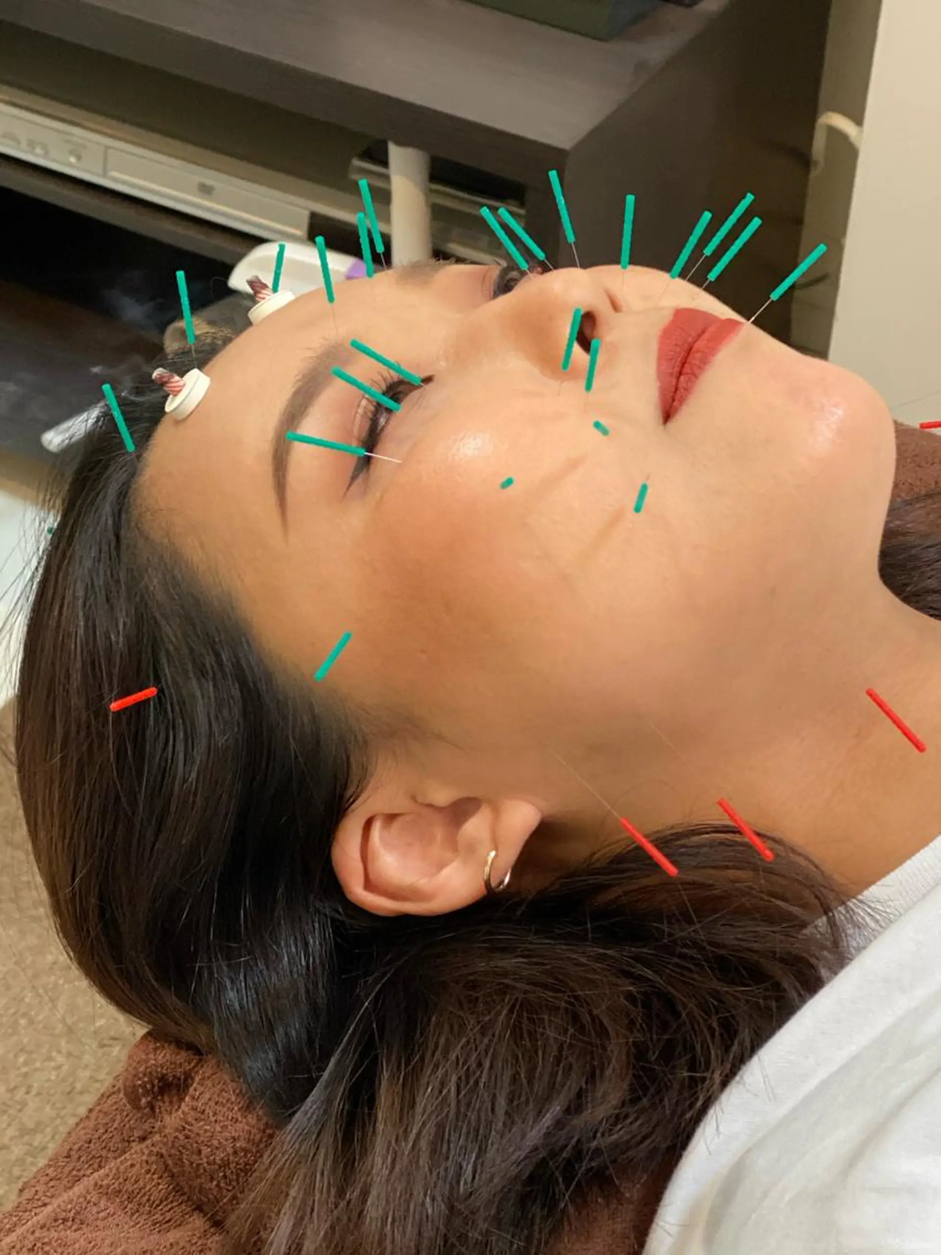 美容鍼 蕾【谷町六丁目】のエステ・リラクイメージ