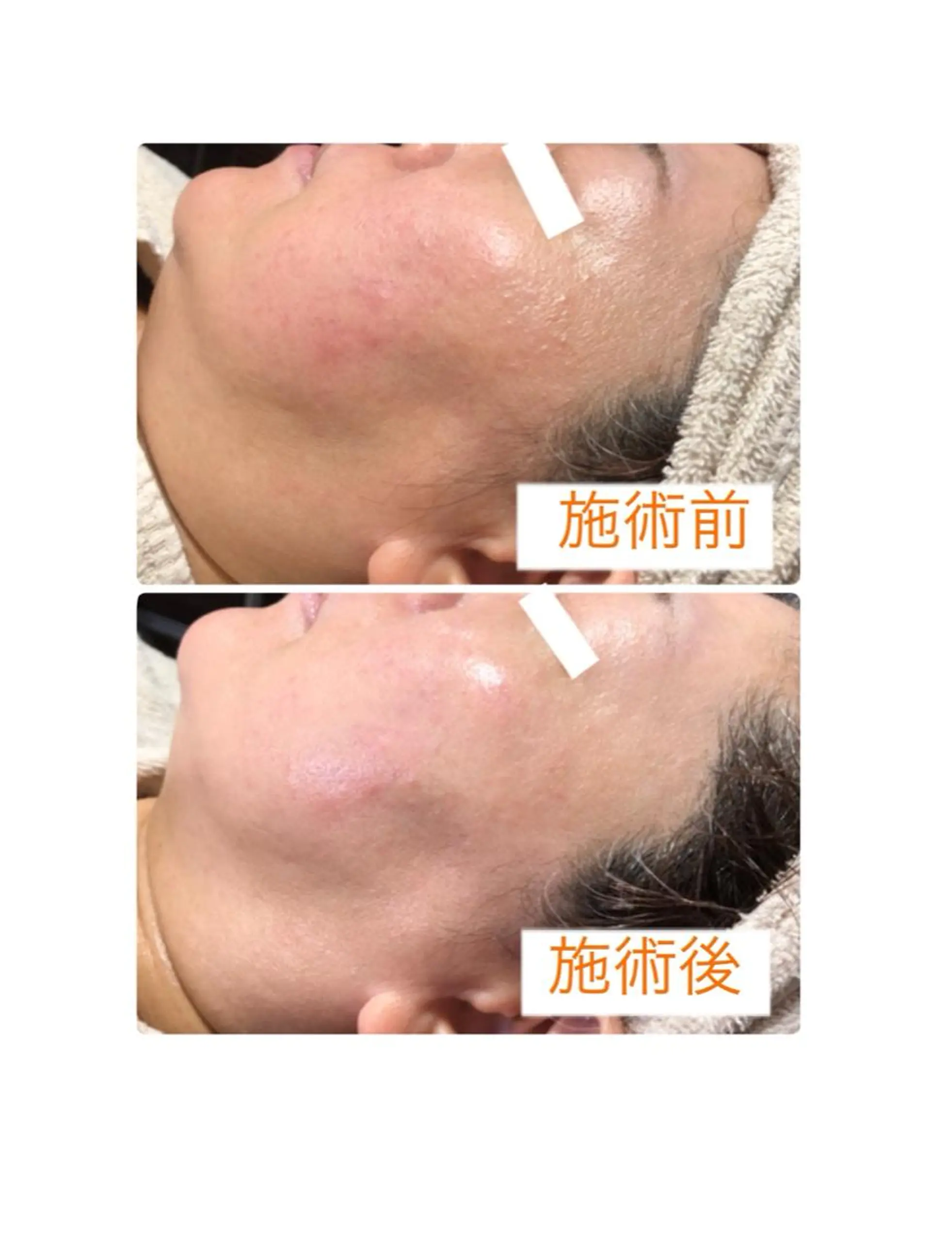 エステ 小顔・毛穴・たるみ ネイル　似内真樹のエステ・リラクイメージ