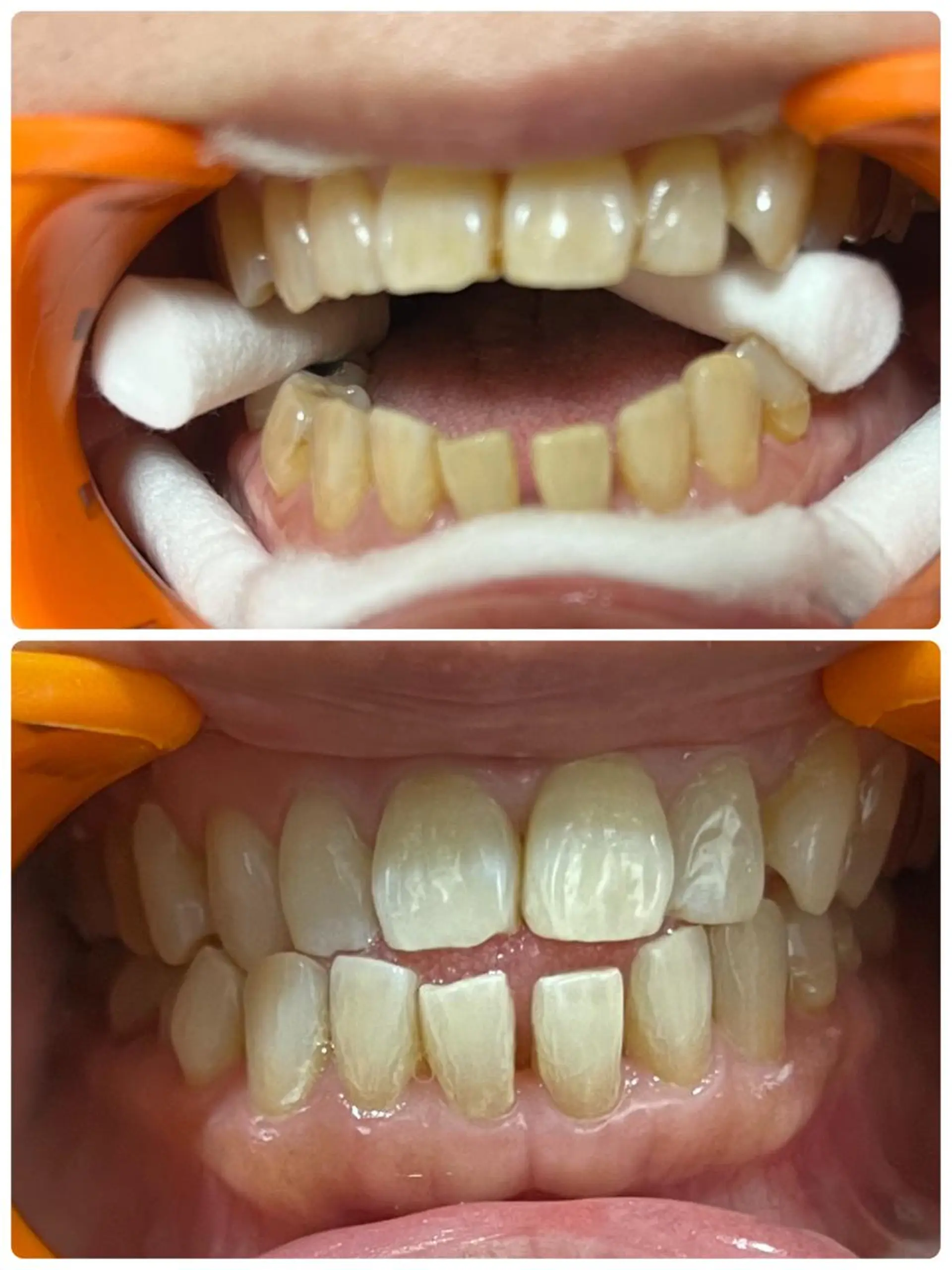 エステ リラク ベルーテ エッセンスのエステ・リラクイメージ