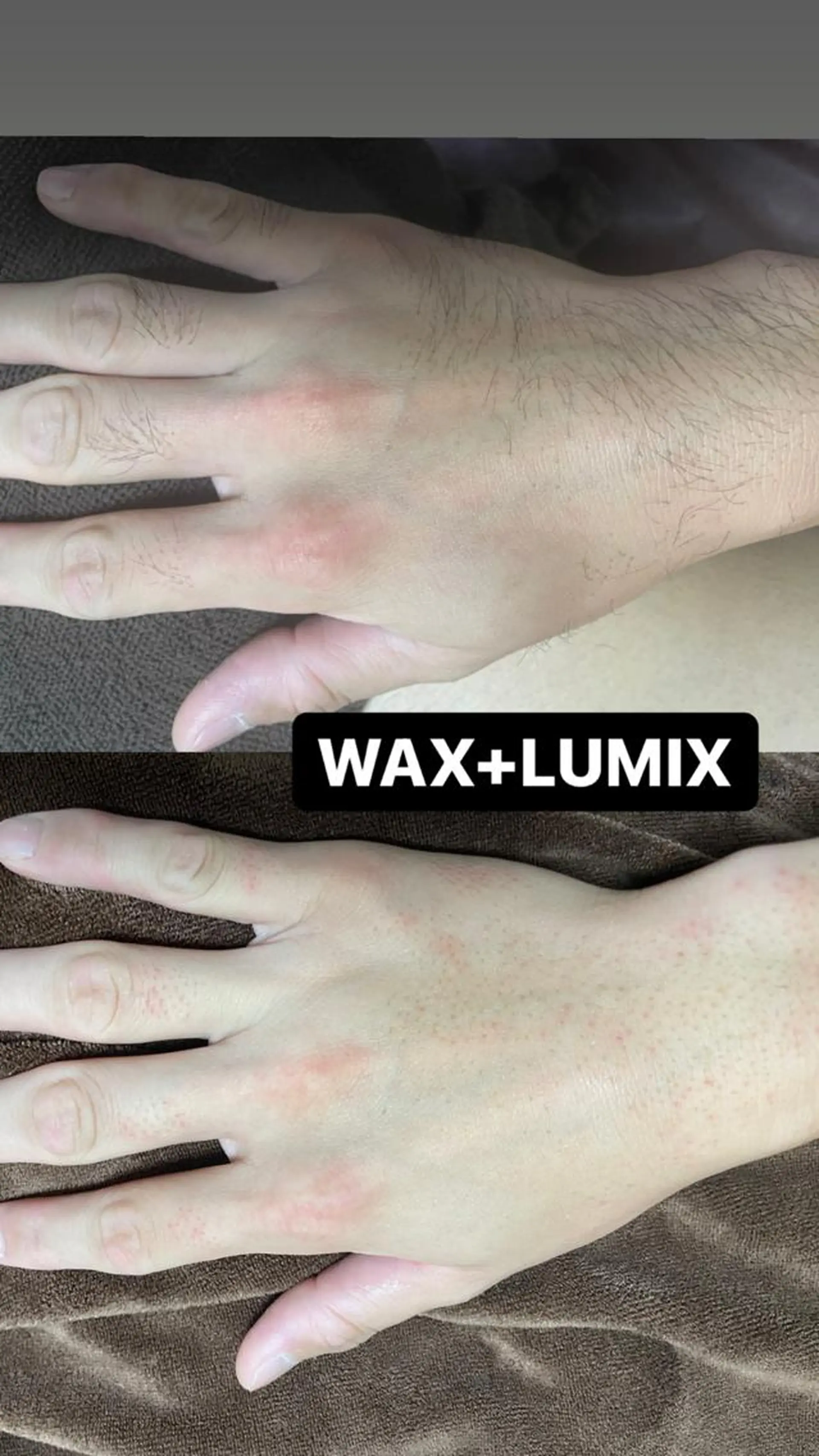 キッズ メンズ 脱毛 Epina 千葉店 【エピナ】のエステ・リラクイメージ