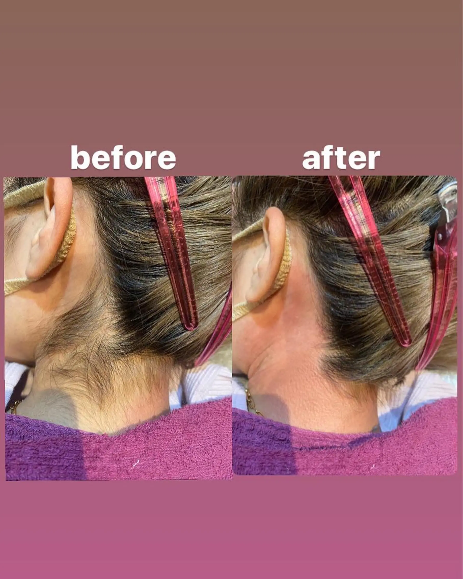 脱毛 re-born🎀 mihoのエステ・リラクイメージ